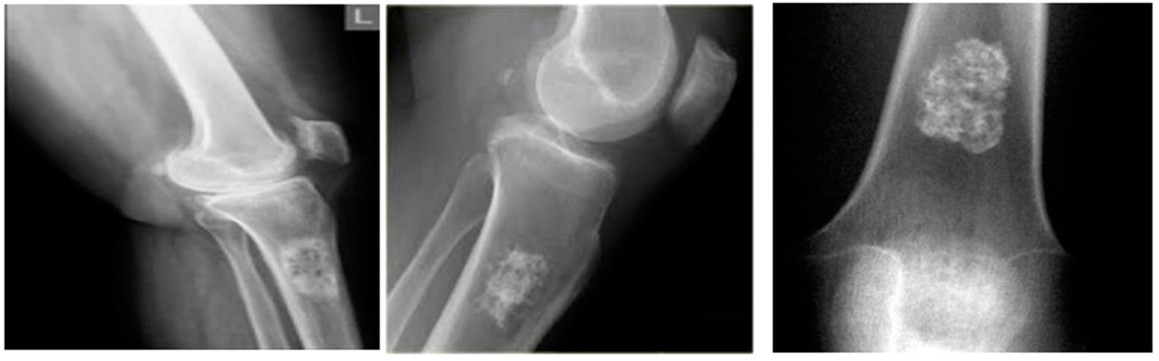 Diagnostics 13 00757 g003 Diagnostics 13 00757 g003