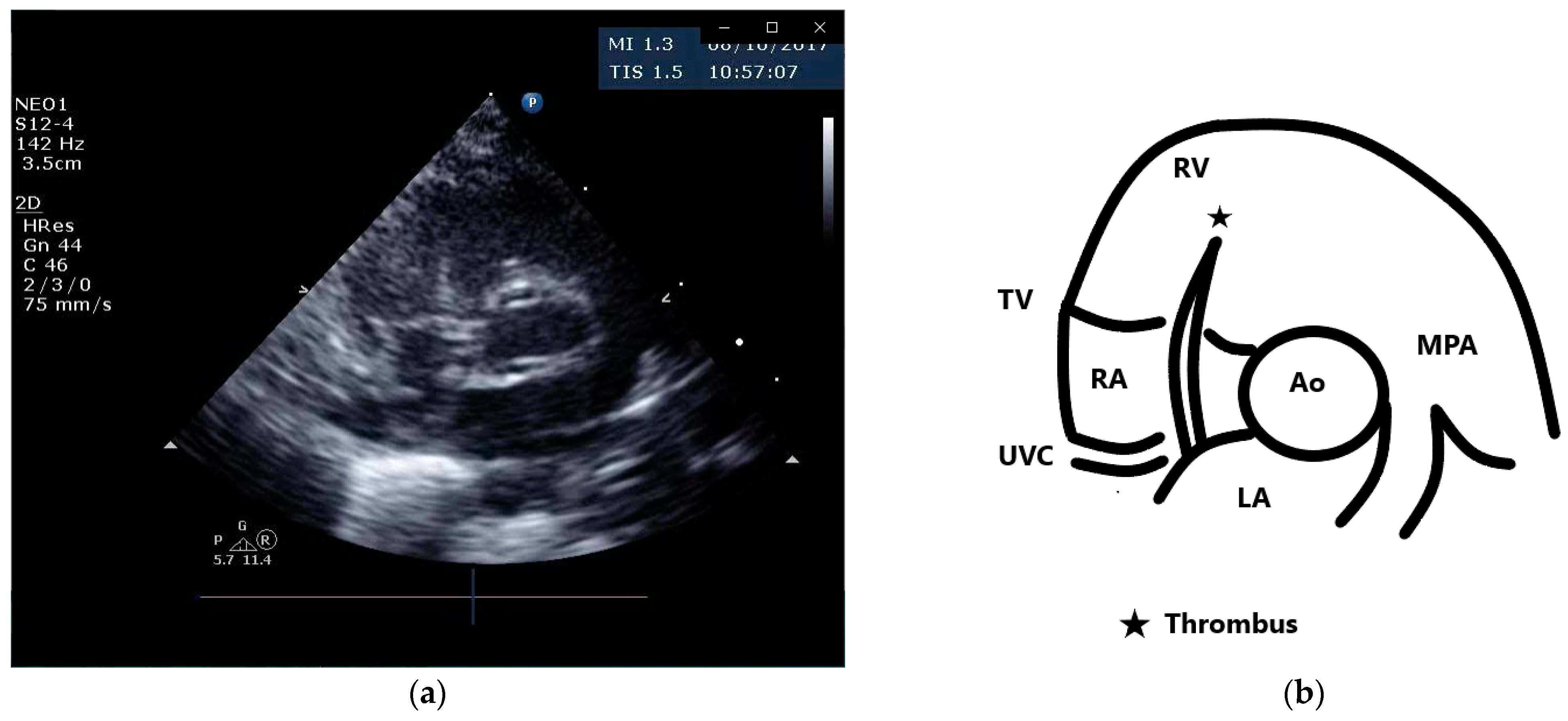 Diagnostics 13 00764 g001