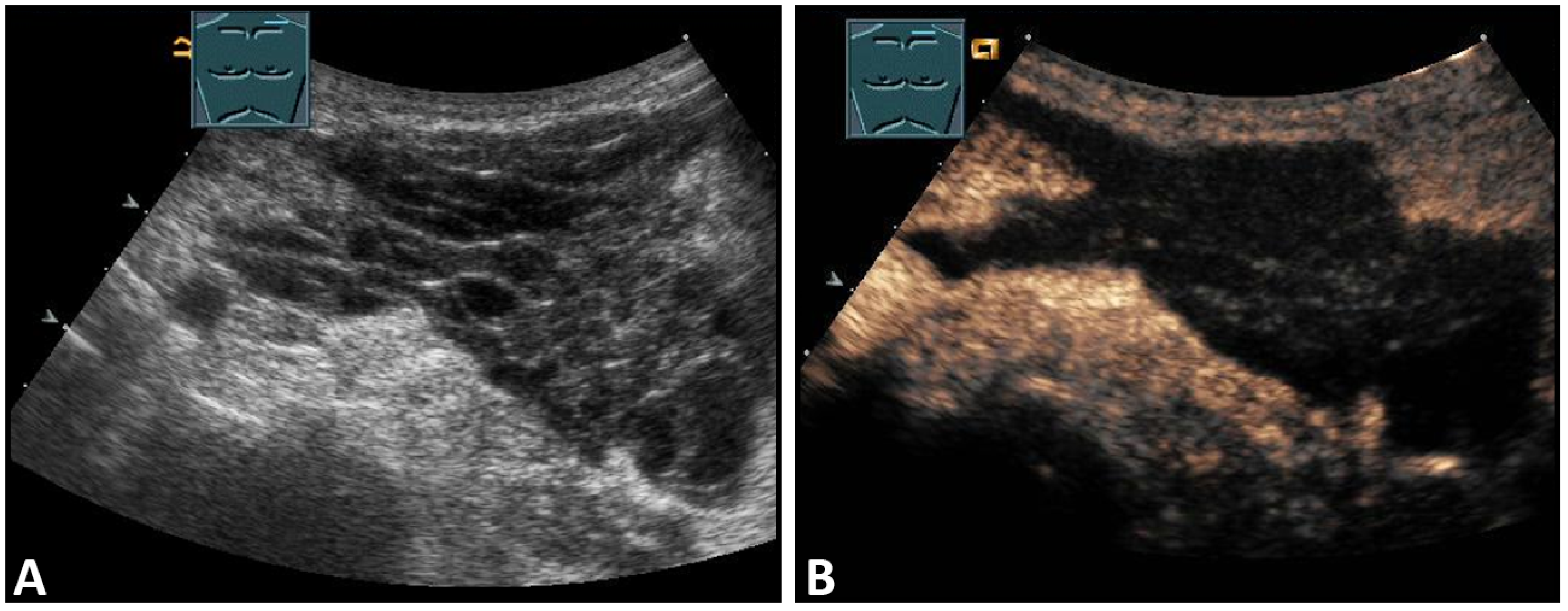 Diagnostics 13 00767 g002