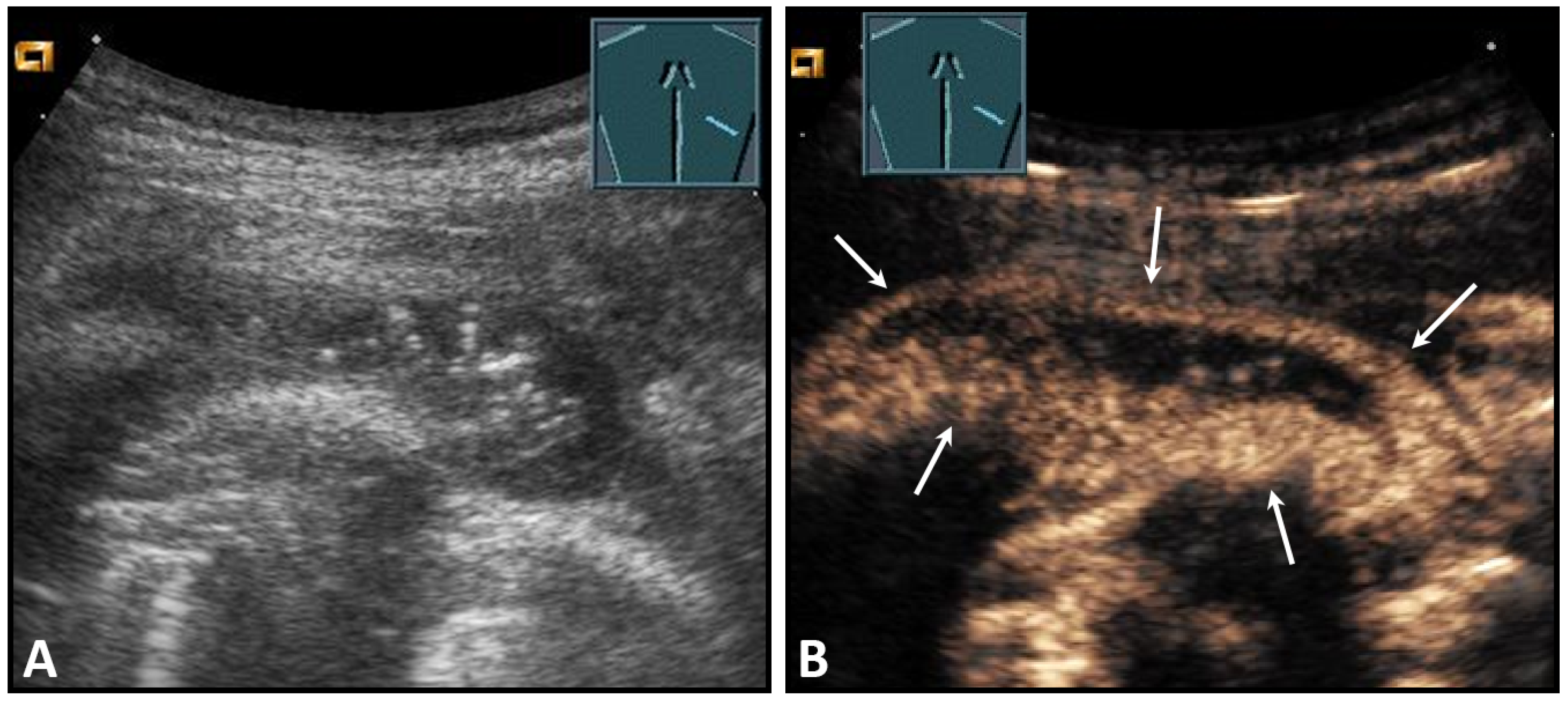 Diagnostics 13 00767 g003