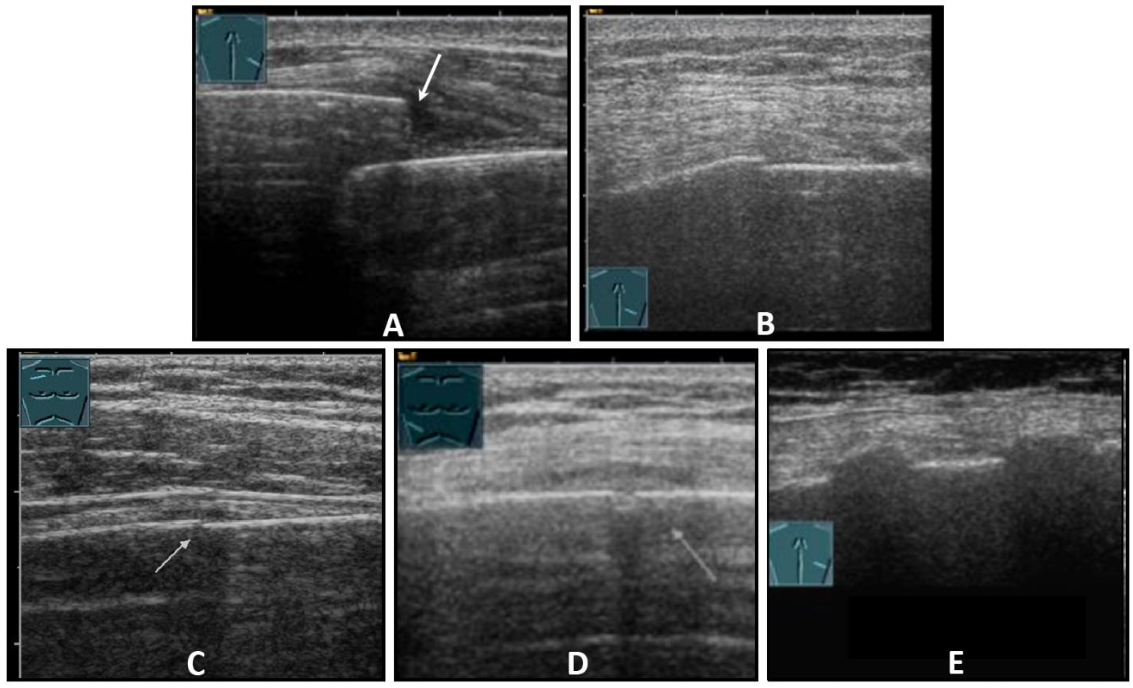 Diagnostics 13 00767 g004