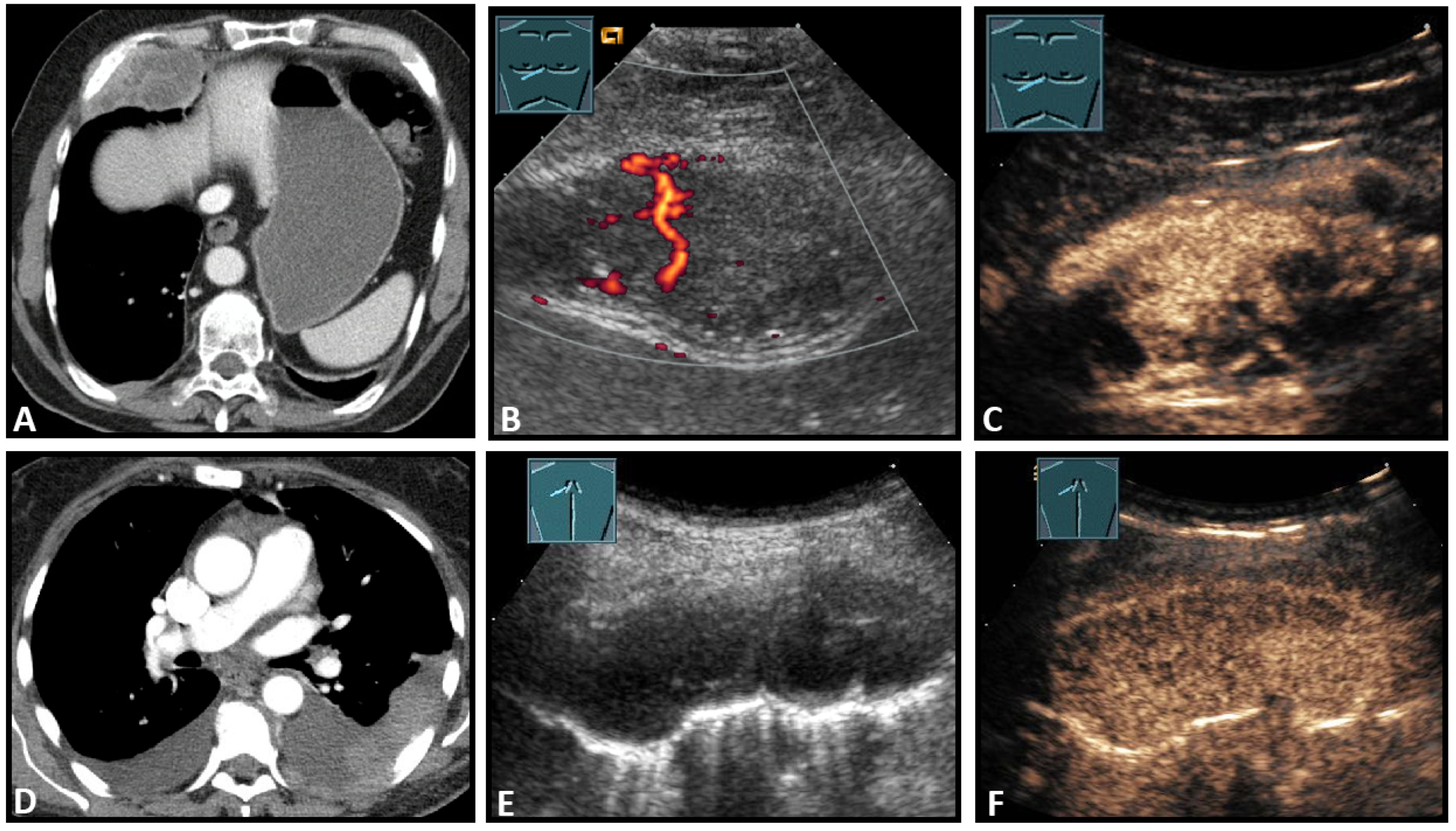 Diagnostics 13 00767 g008