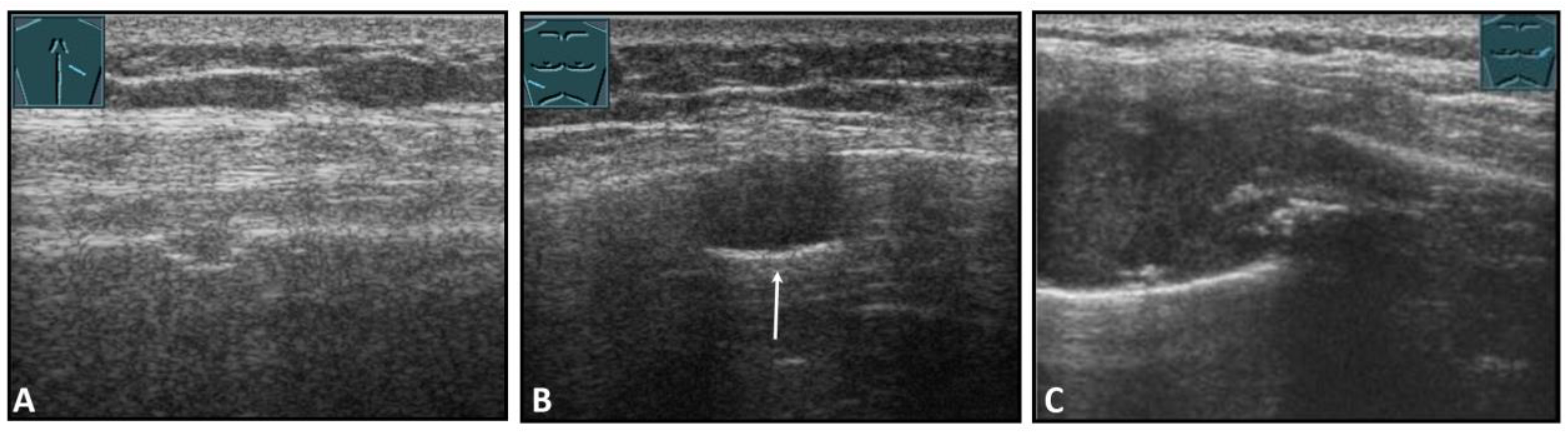 Diagnostics 13 00767 g011