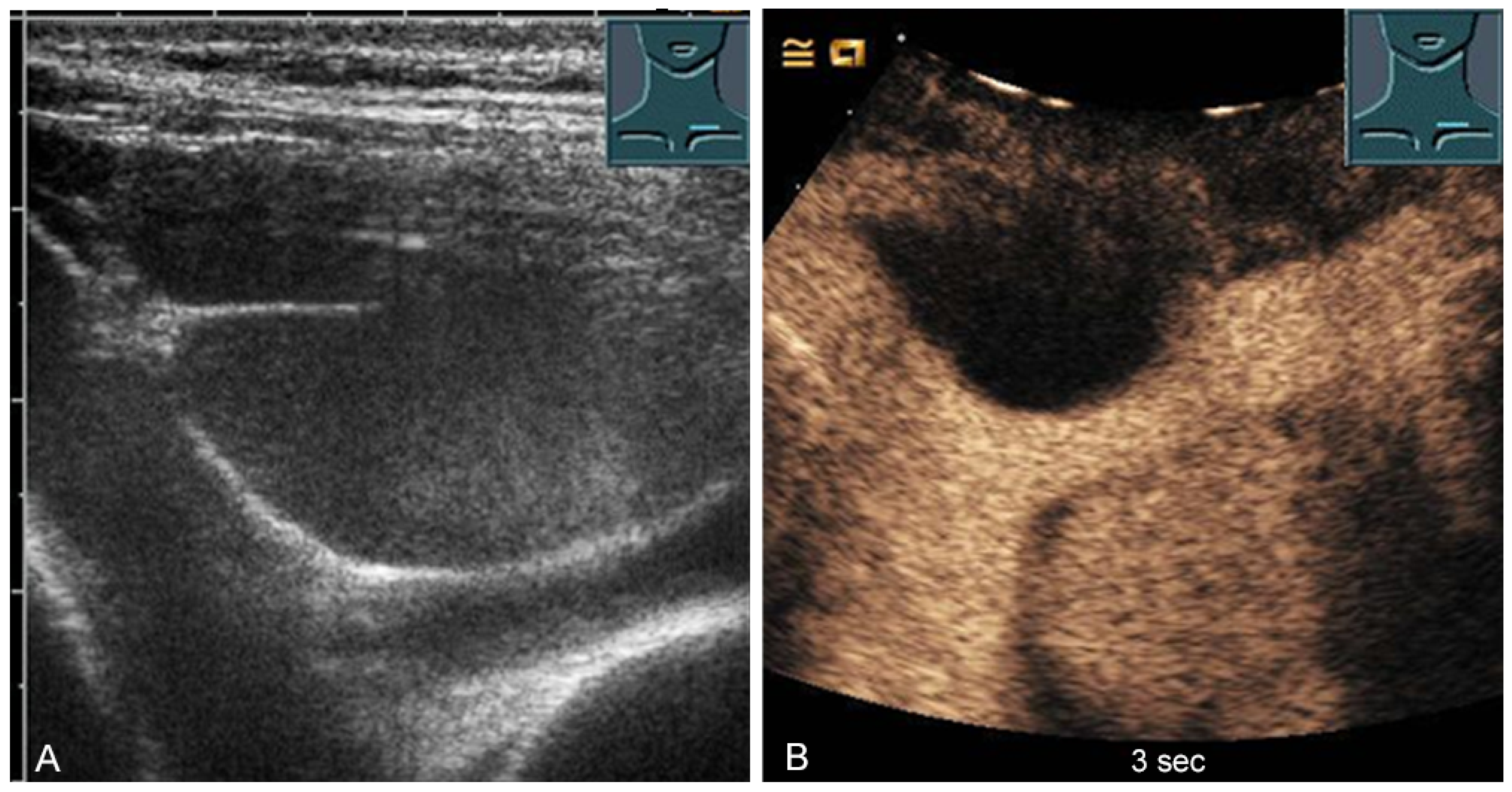 Diagnostics 13 00767 g012
