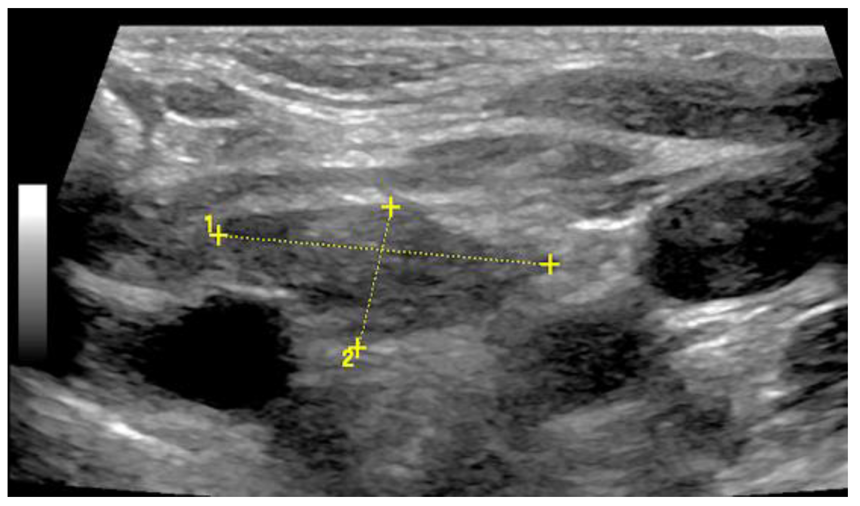 Diagnostics 13 00767 g013
