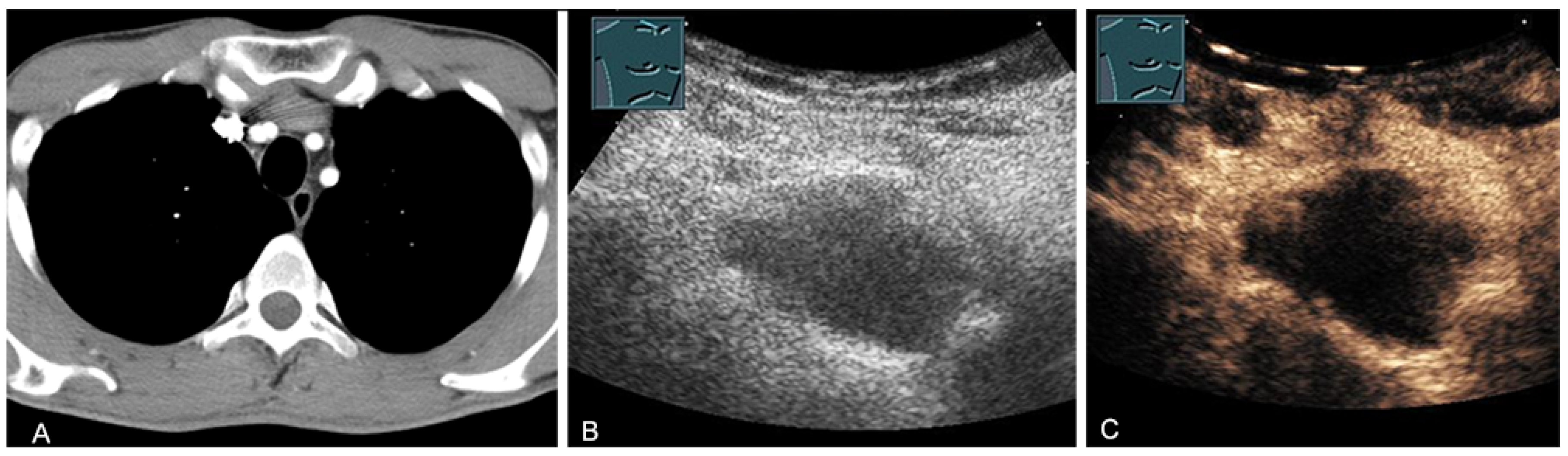 Diagnostics 13 00767 g014