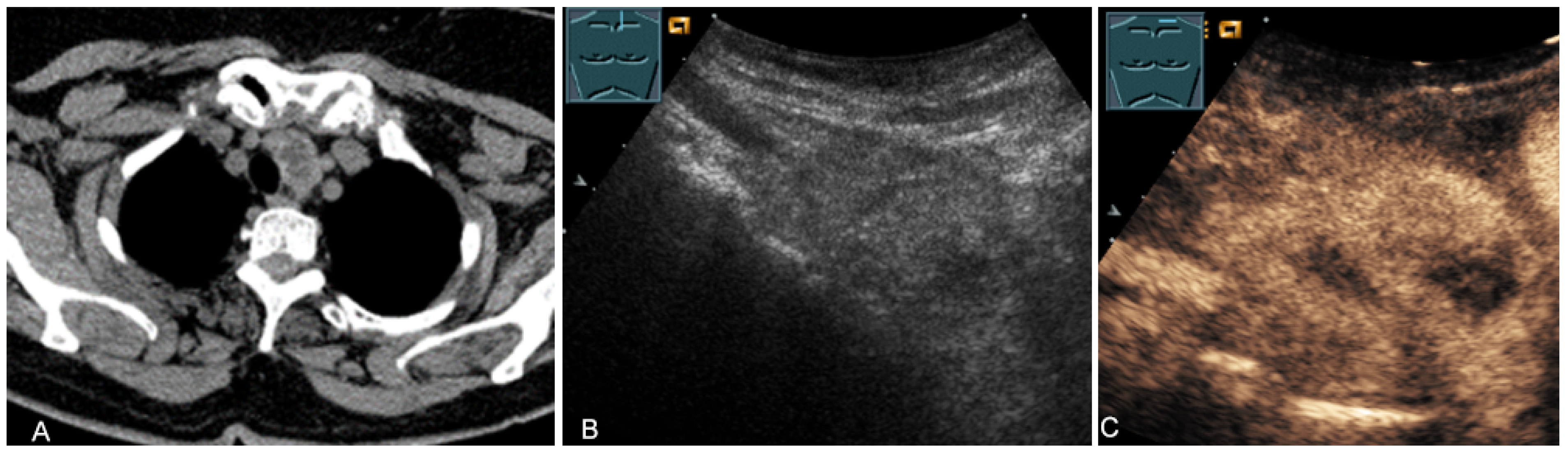 Diagnostics 13 00767 g015