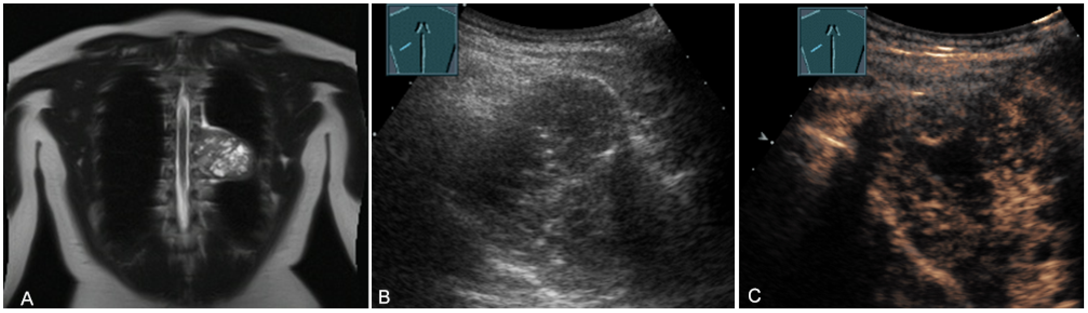 Diagnostics 13 00767 g018