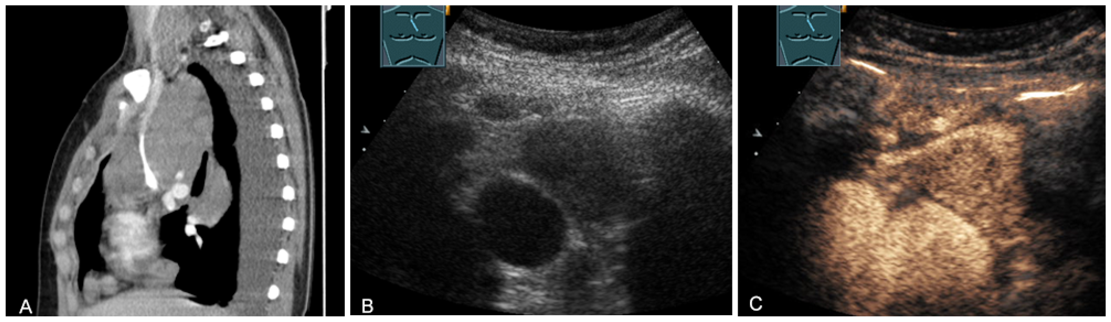 Diagnostics 13 00767 g021