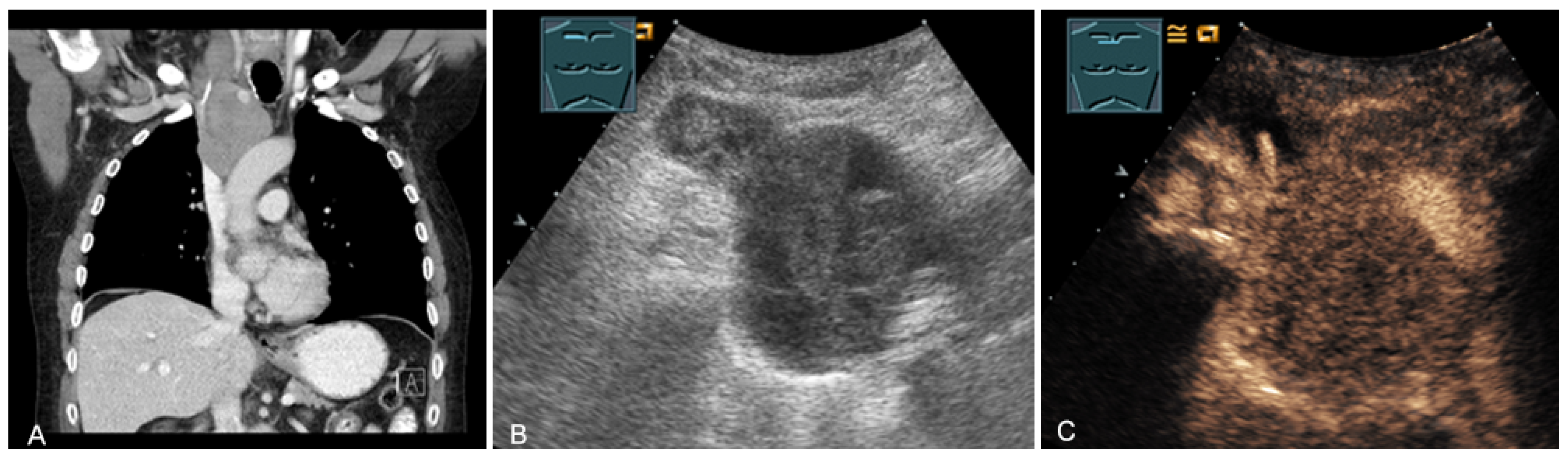 Diagnostics 13 00767 g022