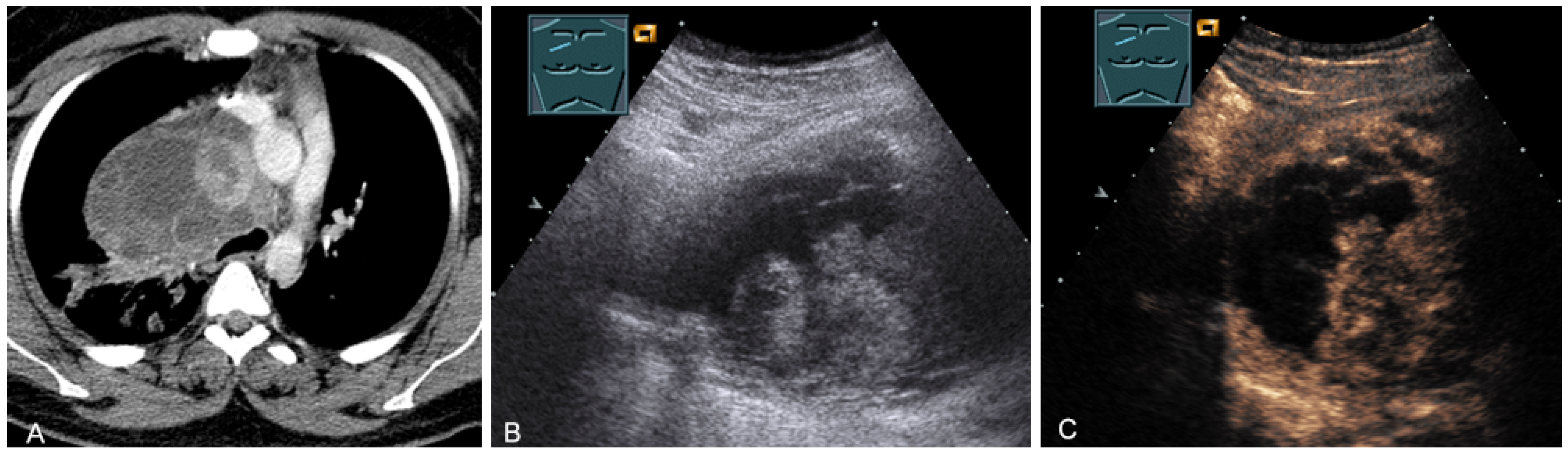 Diagnostics 13 00767 g023