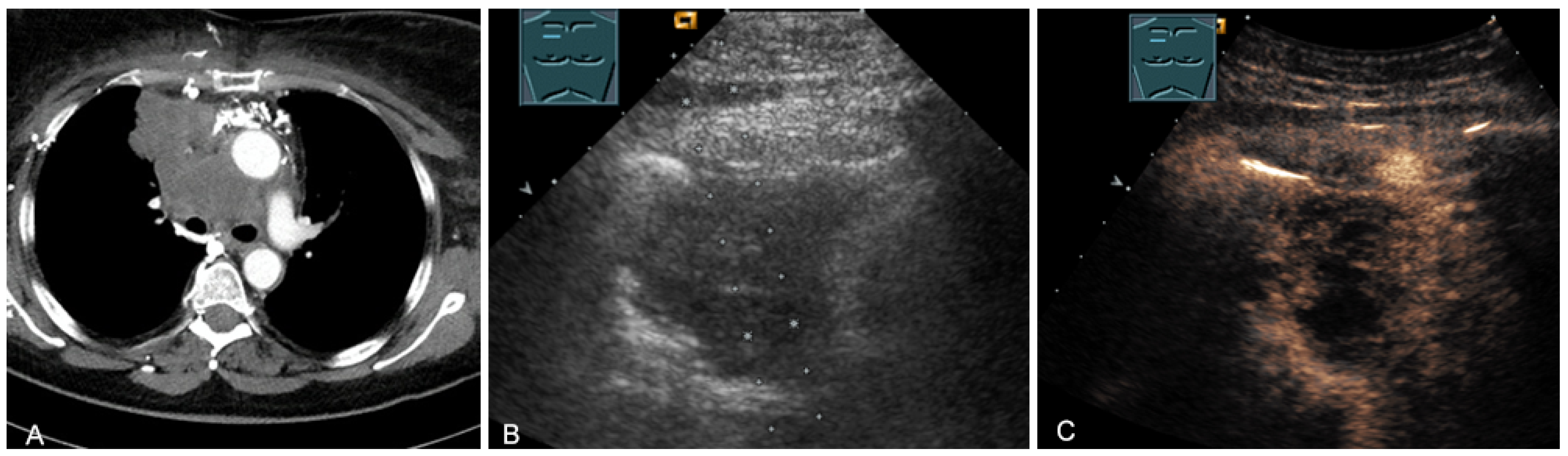 Diagnostics 13 00767 g024