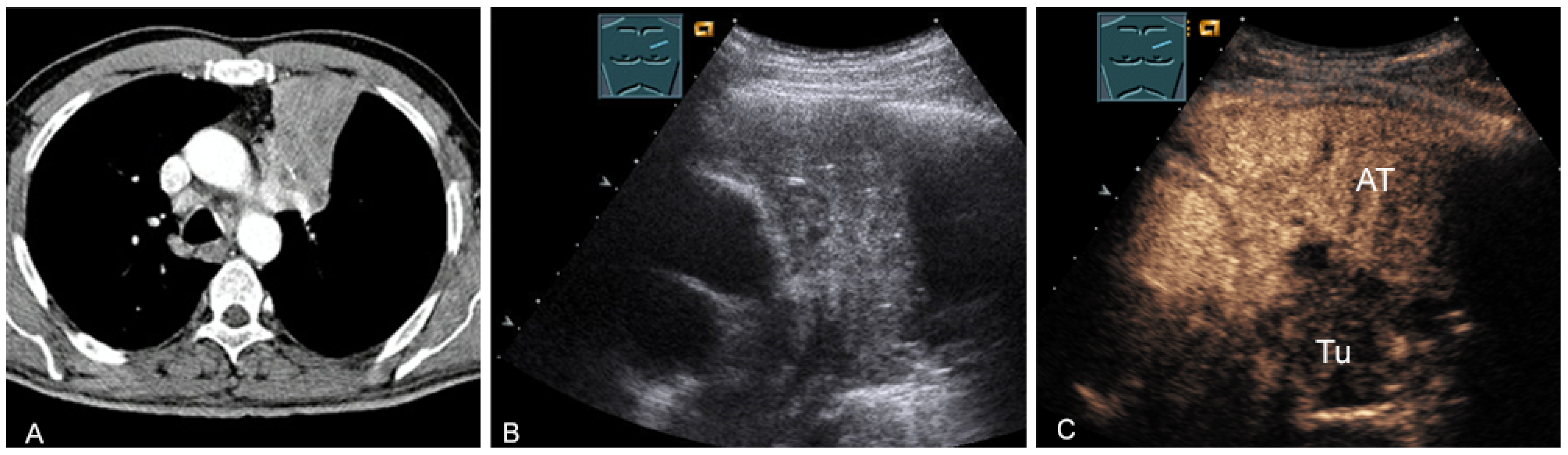 Diagnostics 13 00767 g025