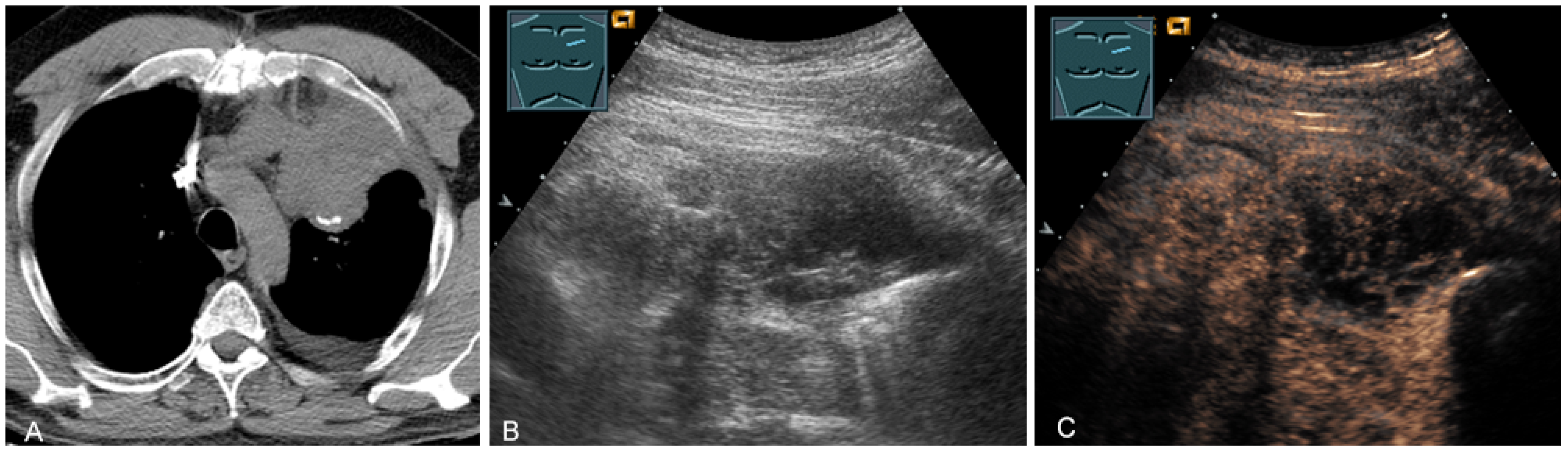 Diagnostics 13 00767 g026