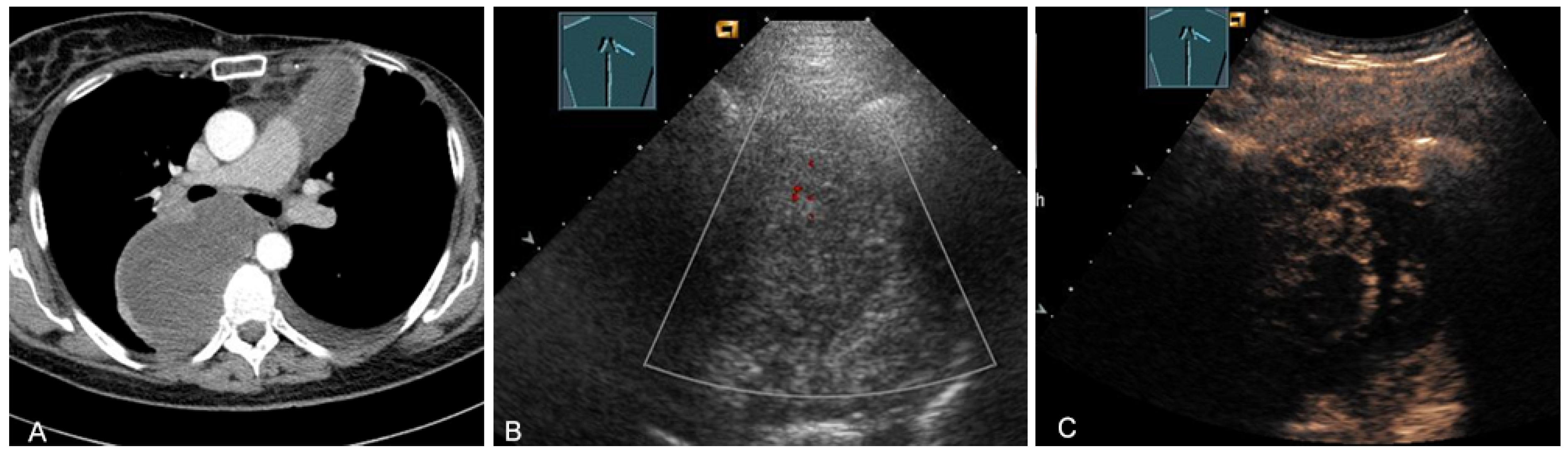 Diagnostics 13 00767 g027