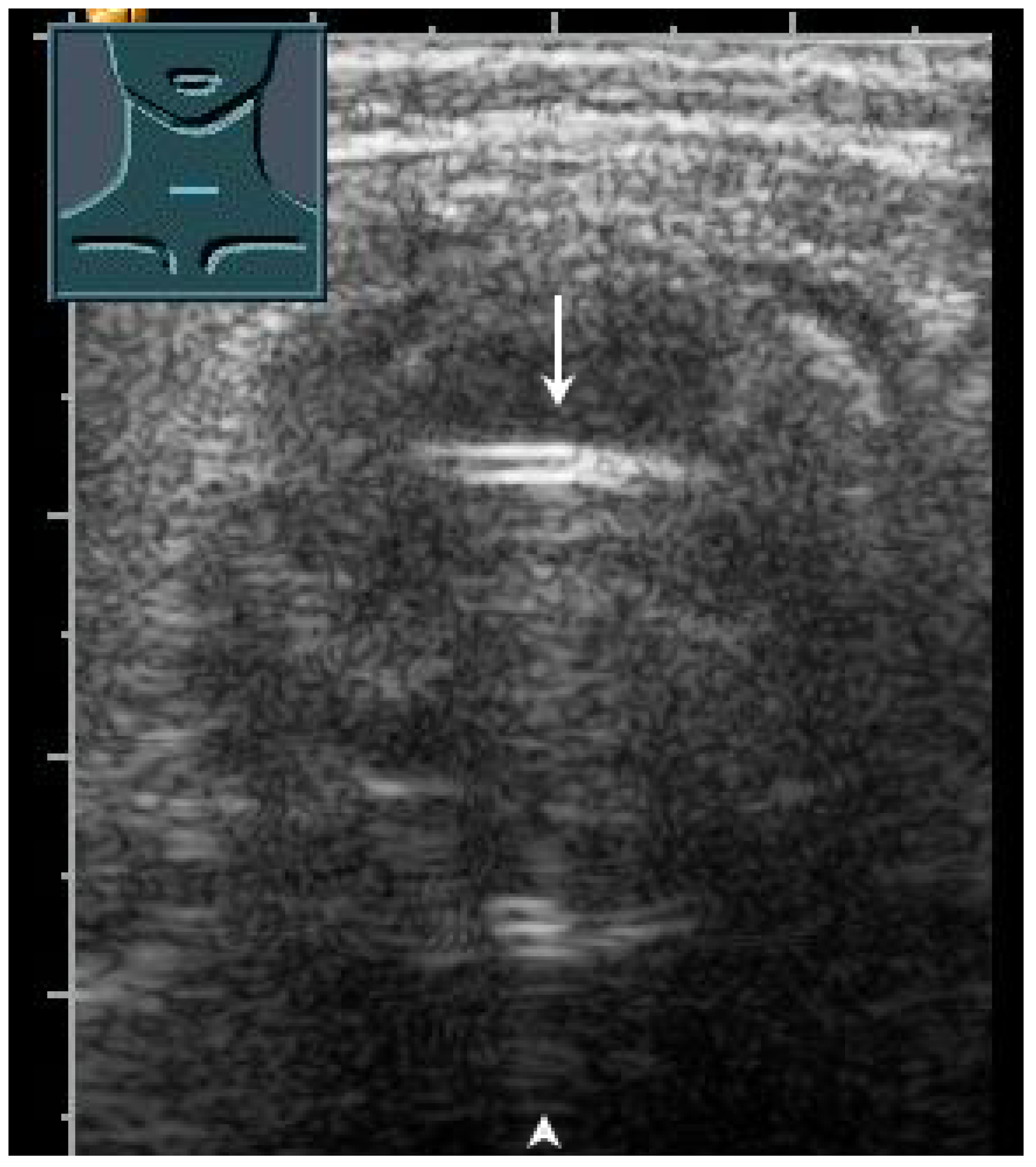 Diagnostics 13 00767 g028