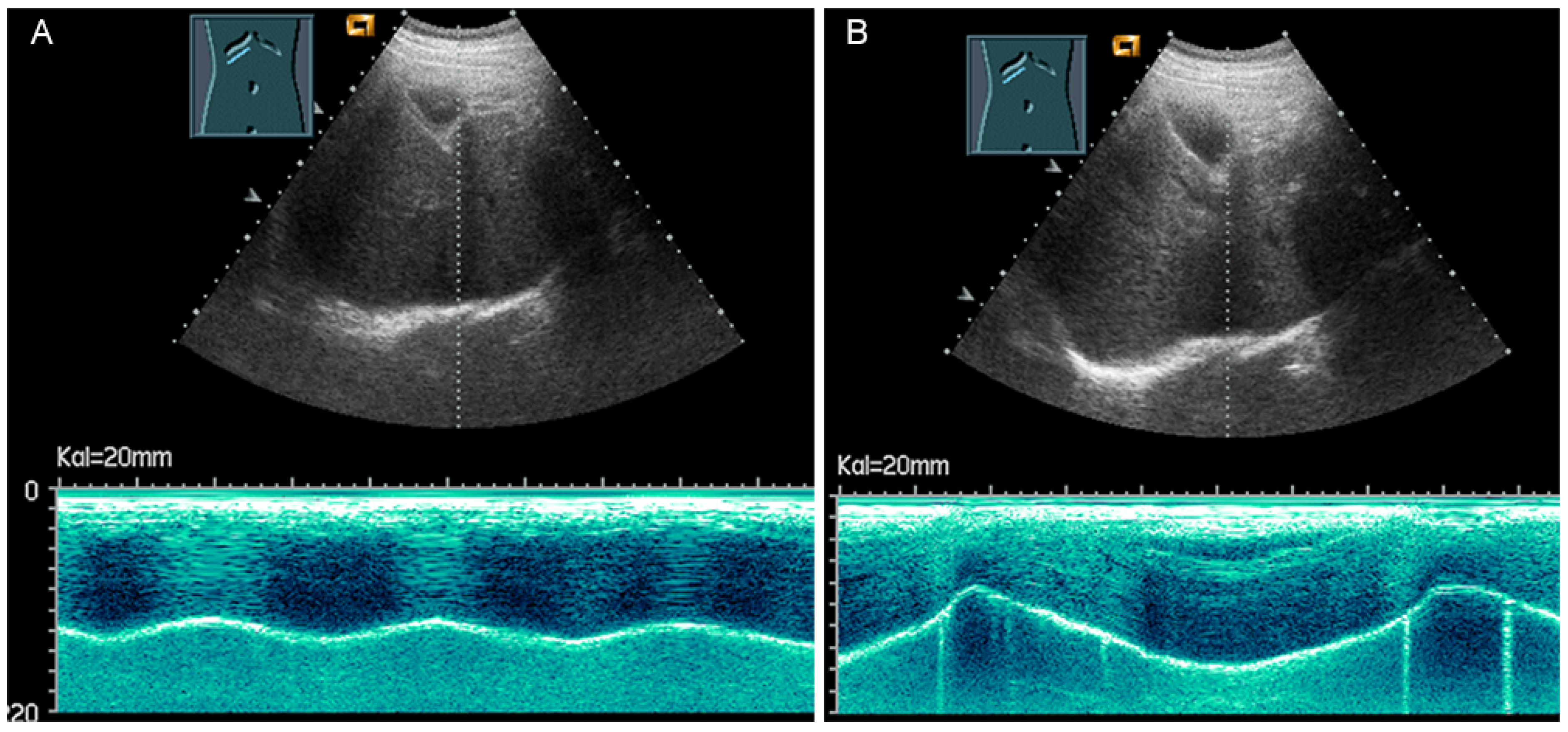 Diagnostics 13 00767 g032
