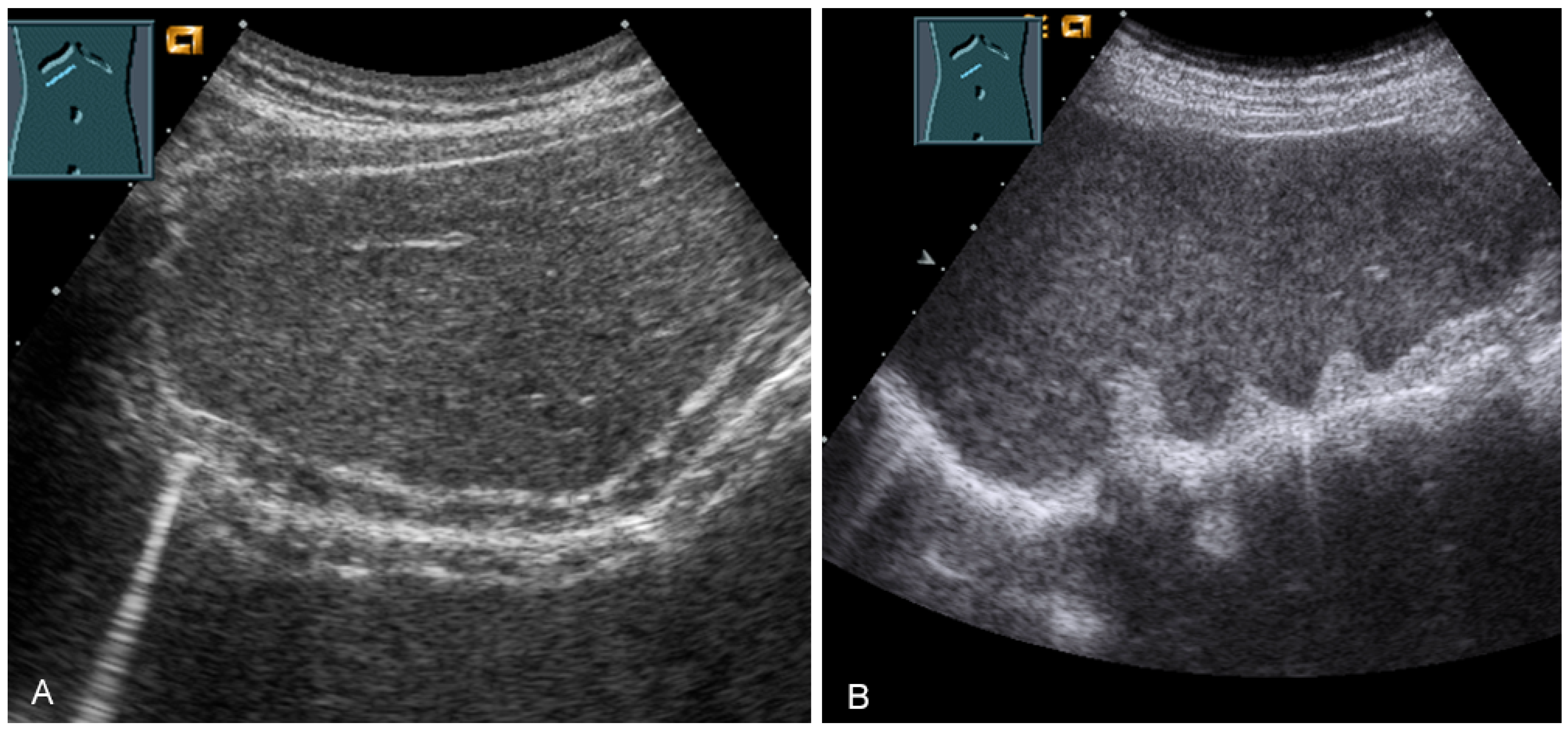 Diagnostics 13 00767 g033