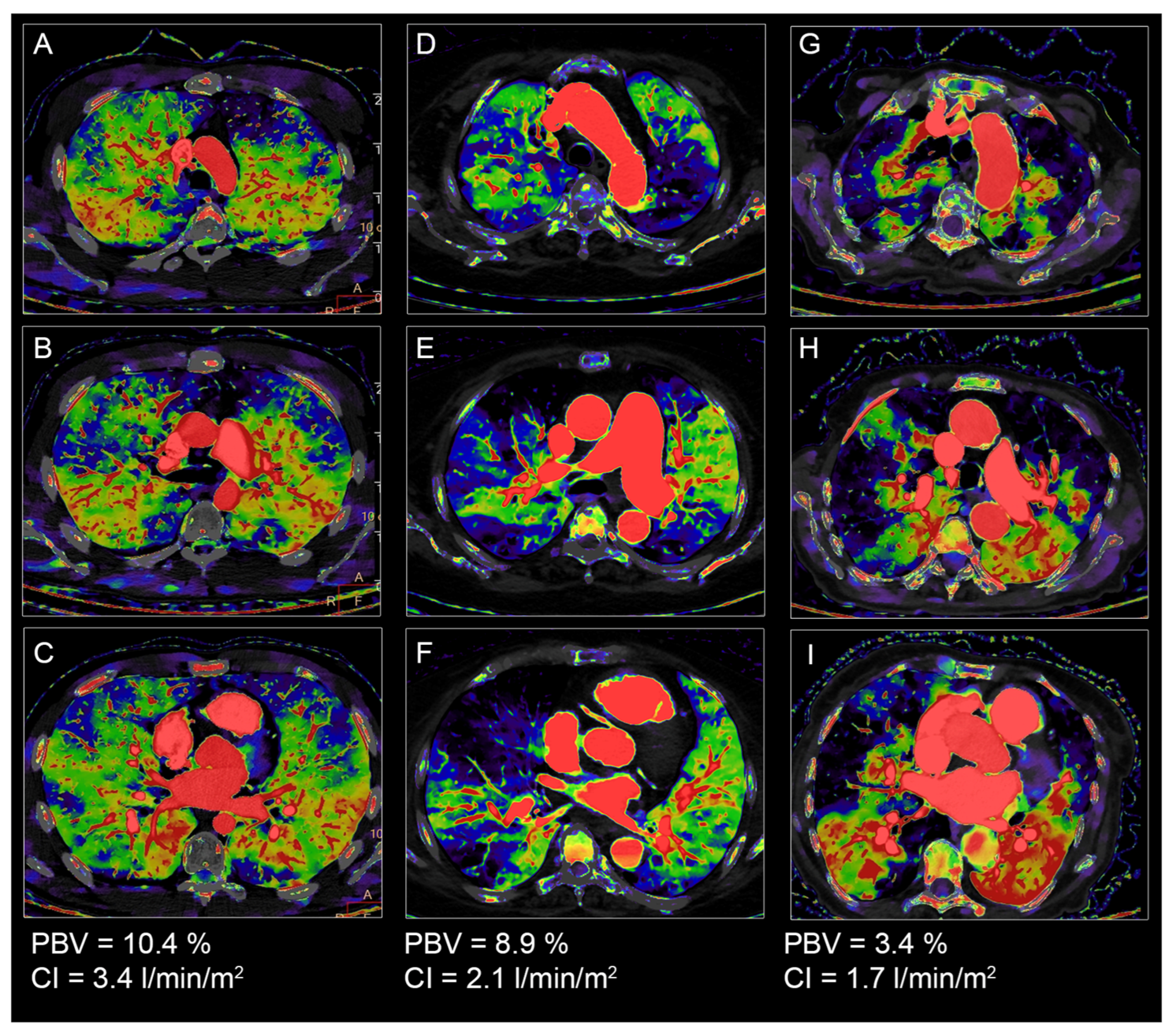 Diagnostics 13 00769 g005 Diagnostics 13 00769 g005