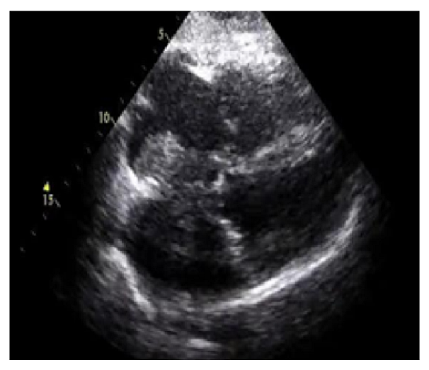 Diagnostics 13 00775 g004