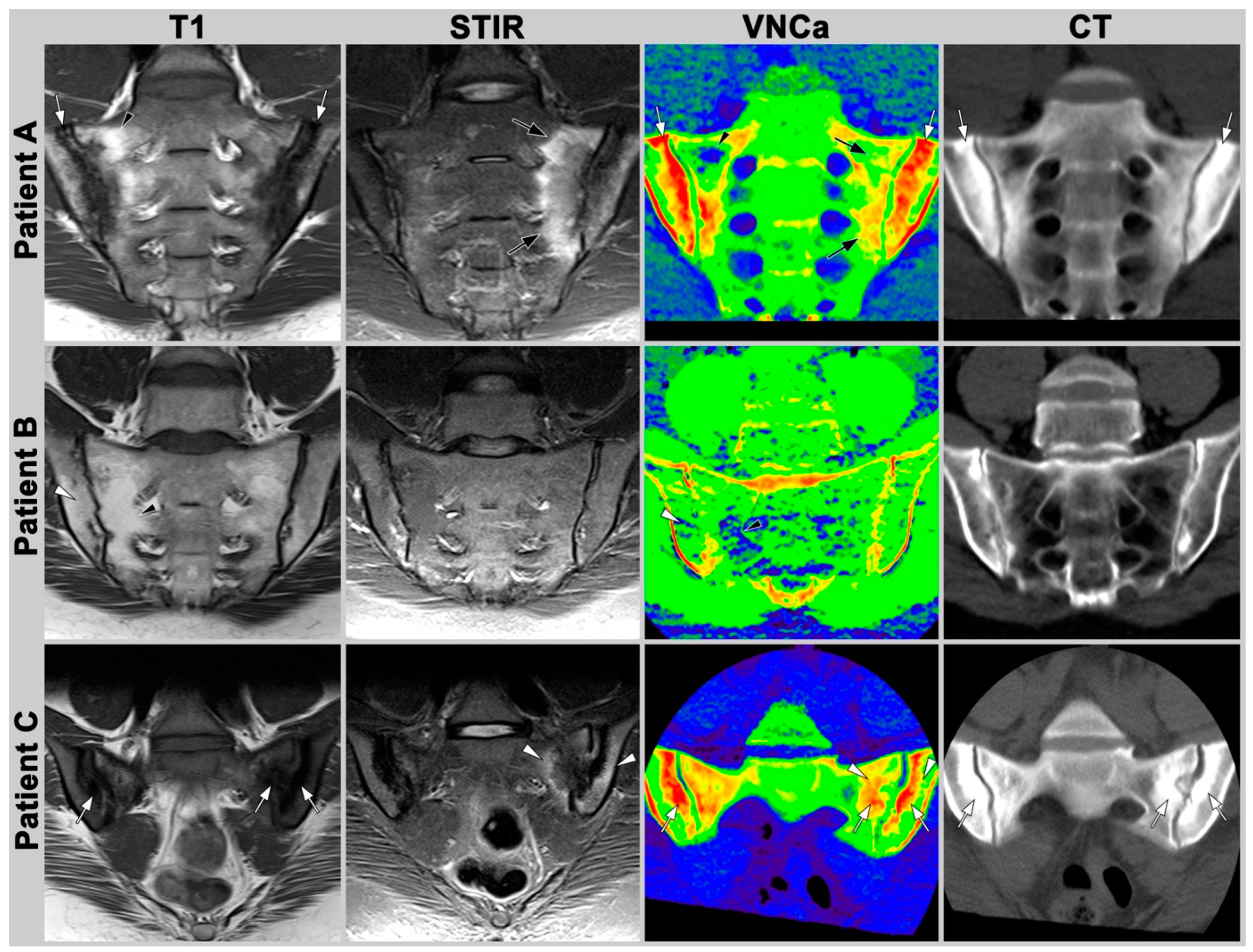 Diagnostics 13 00776 g002