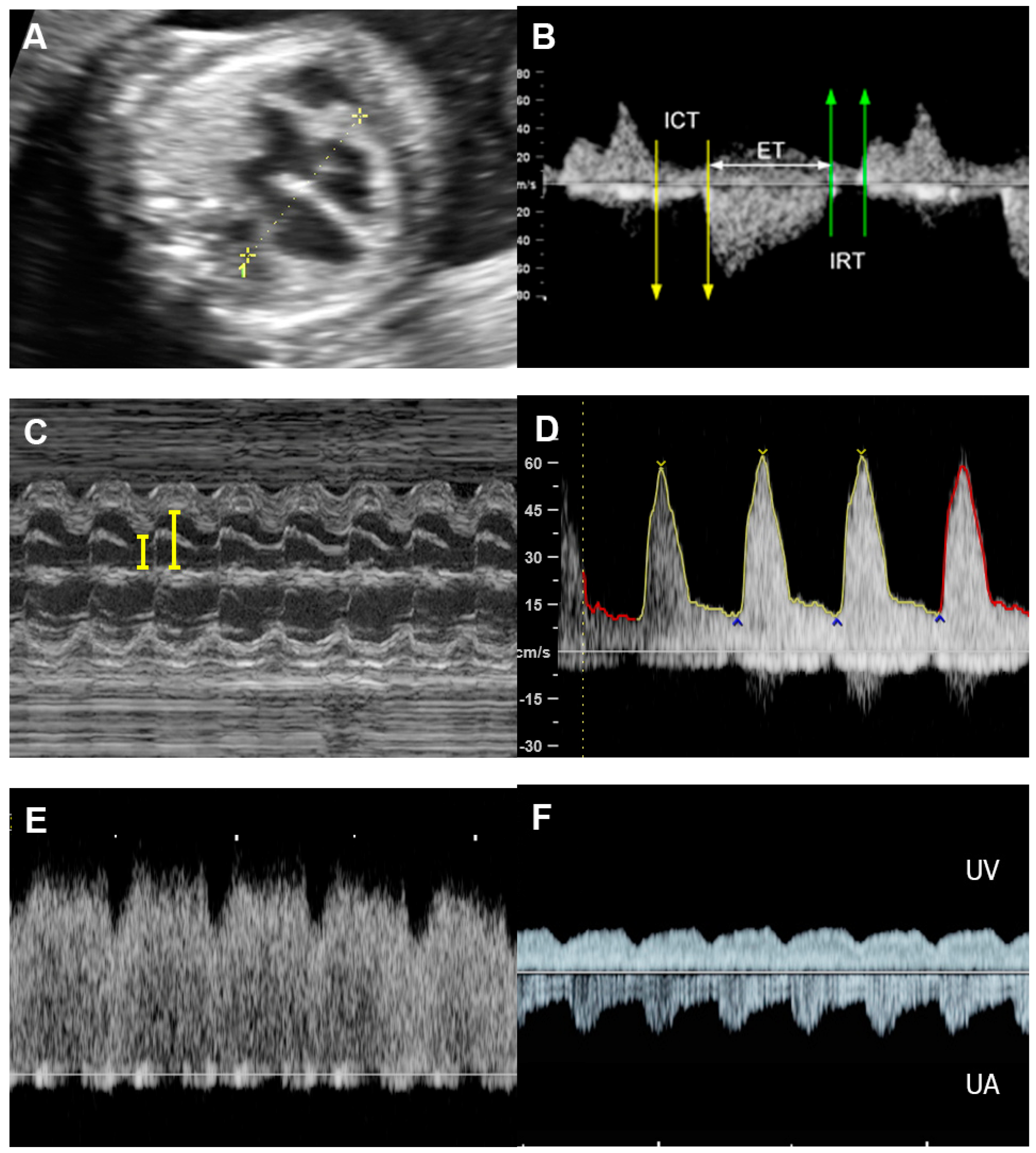Diagnostics 13 00779 g004