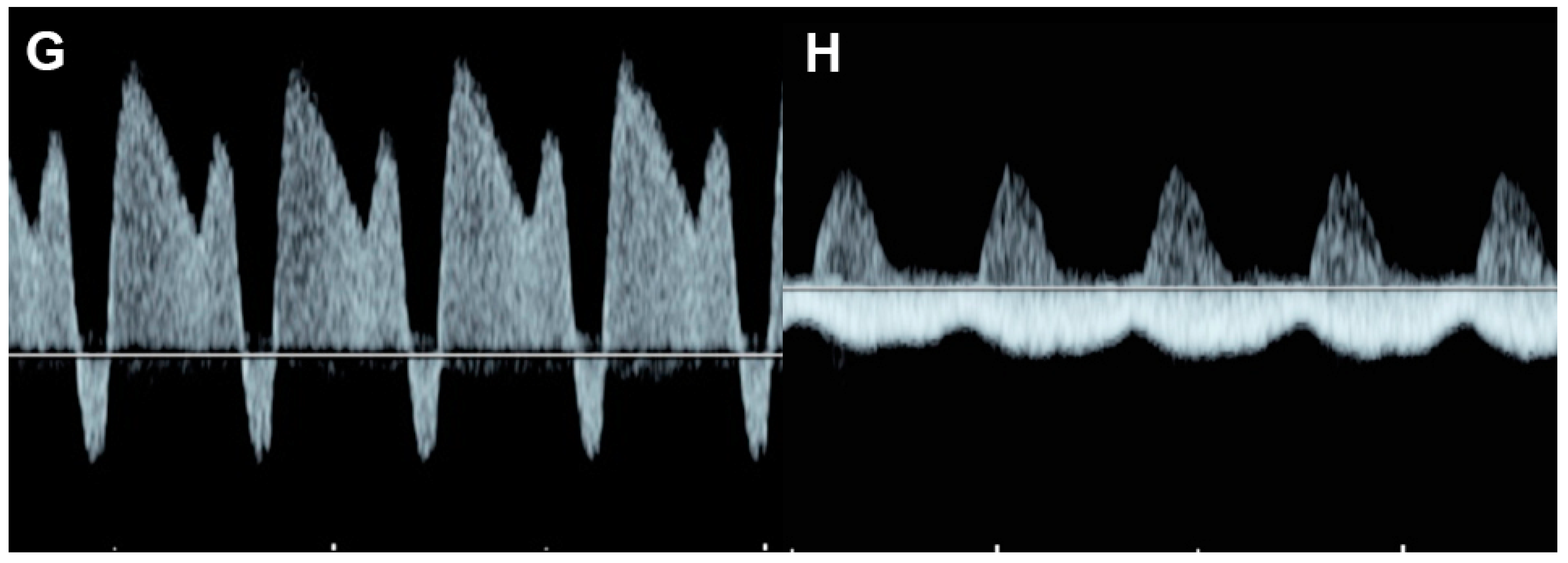 Diagnostics 13 00779 g007b