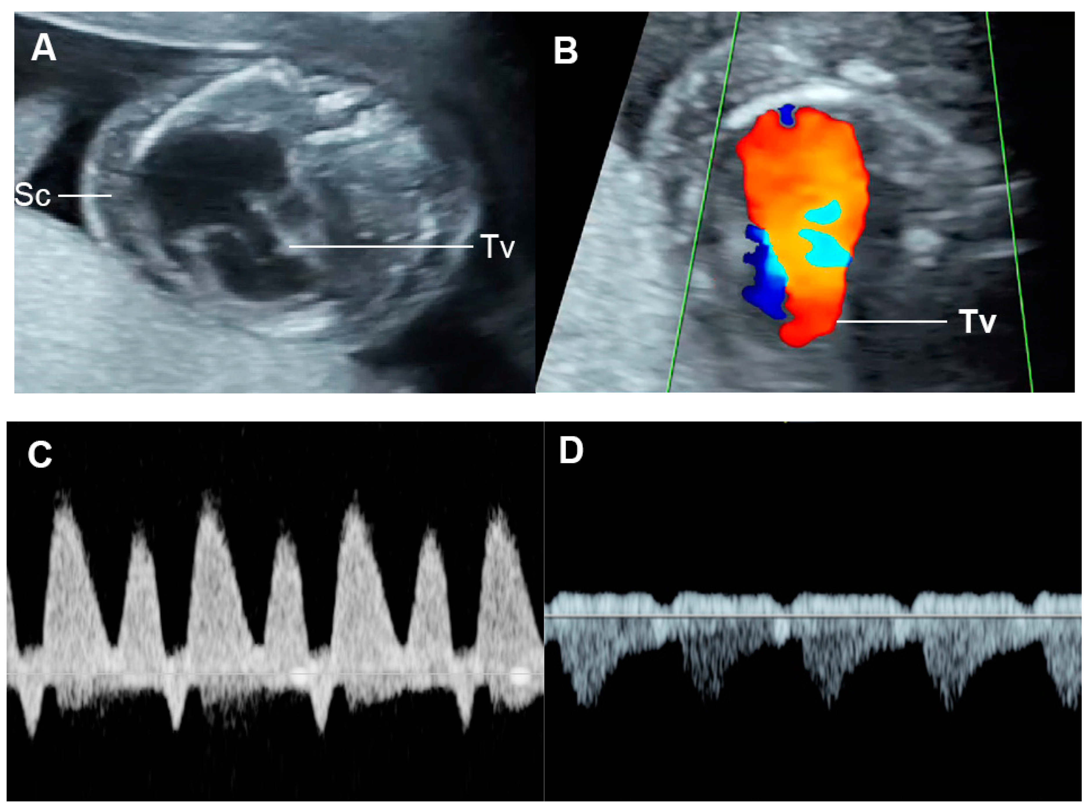 Diagnostics 13 00779 g010