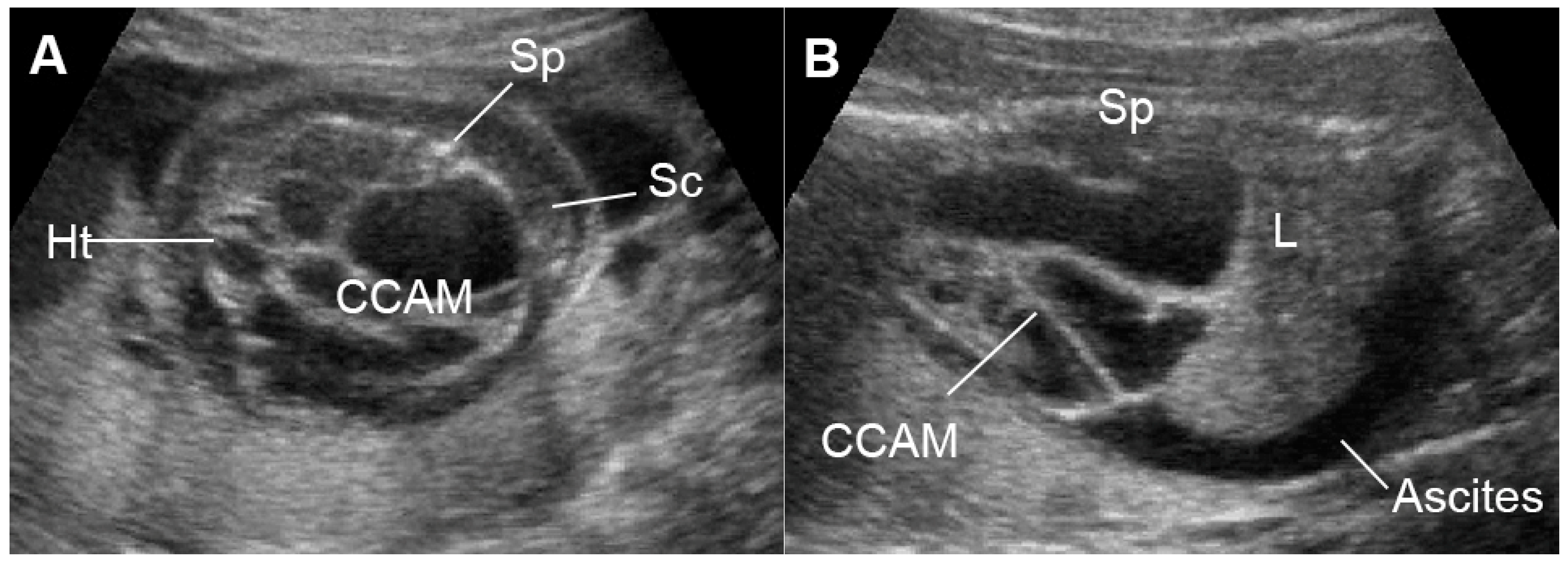 Diagnostics 13 00779 g011