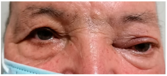 Diagnostics 13 00780 g001