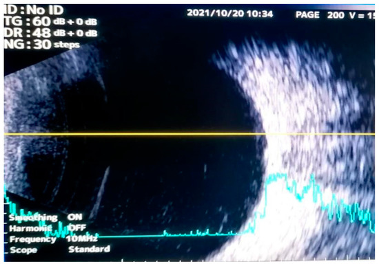 Diagnostics 13 00780 g002
