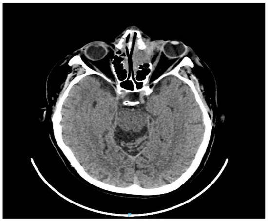 Diagnostics 13 00780 g003