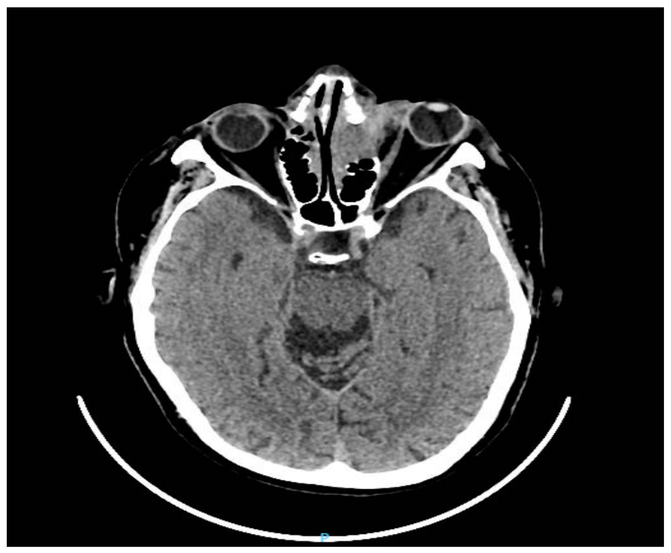Diagnostics 13 00780 g003 Diagnostics 13 00780 g003