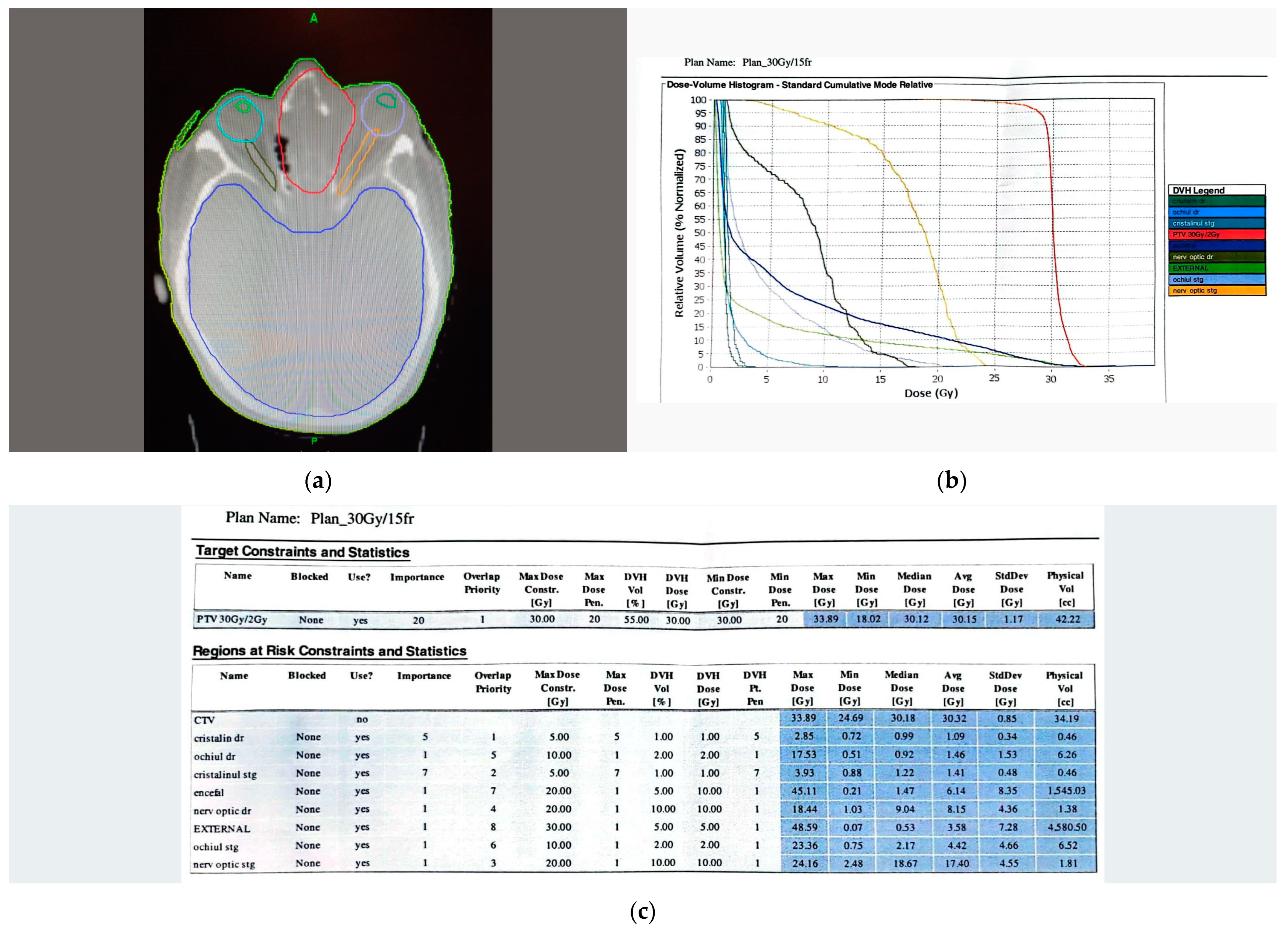 Diagnostics 13 00780 g004 Diagnostics 13 00780 g004