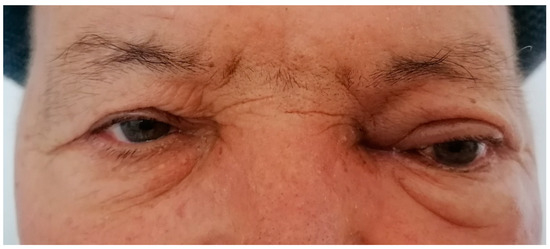 Diagnostics 13 00780 g005