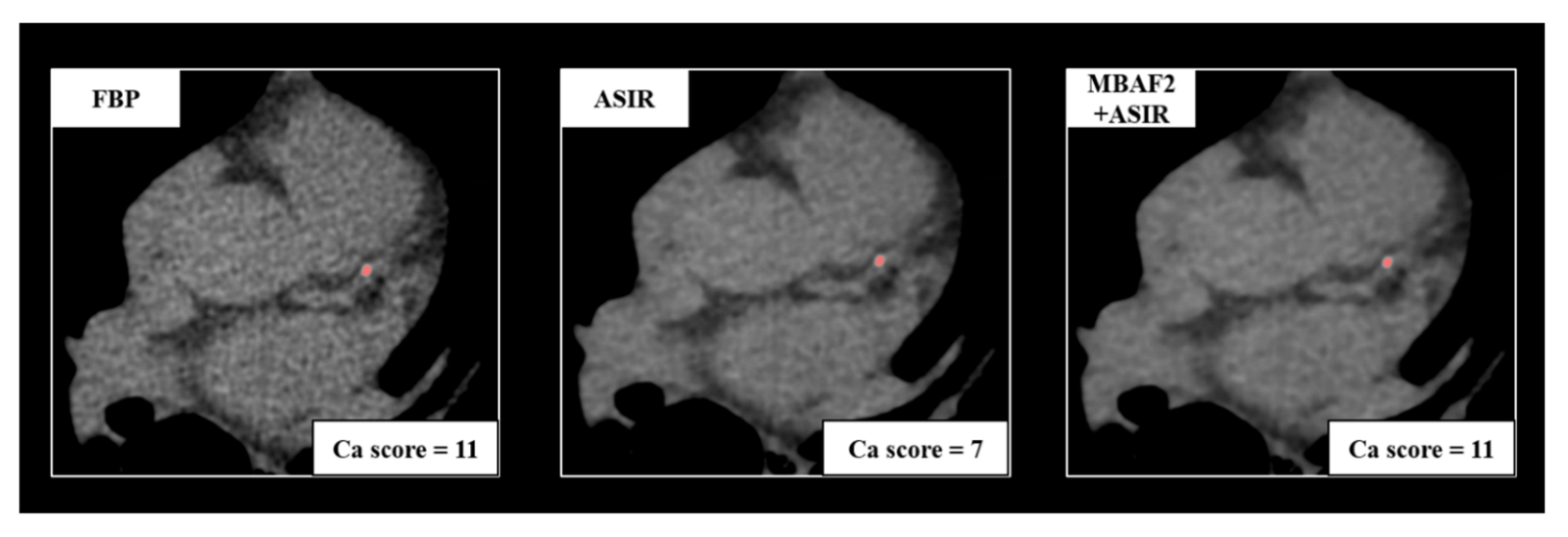 Diagnostics 13 00789 g001 Diagnostics 13 00789 g001