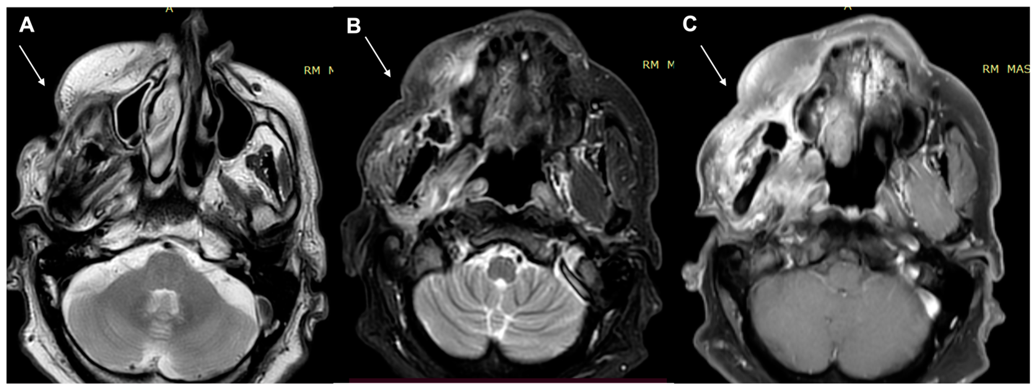 Diagnostics 13 00793 g007