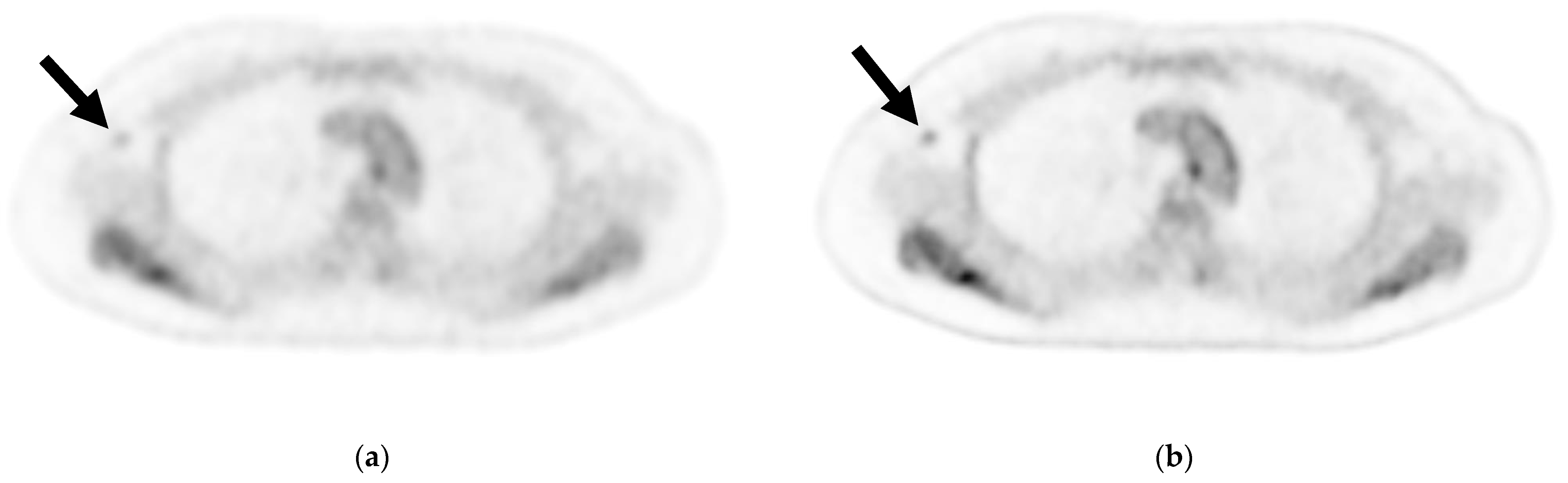 Diagnostics 13 00794 g002