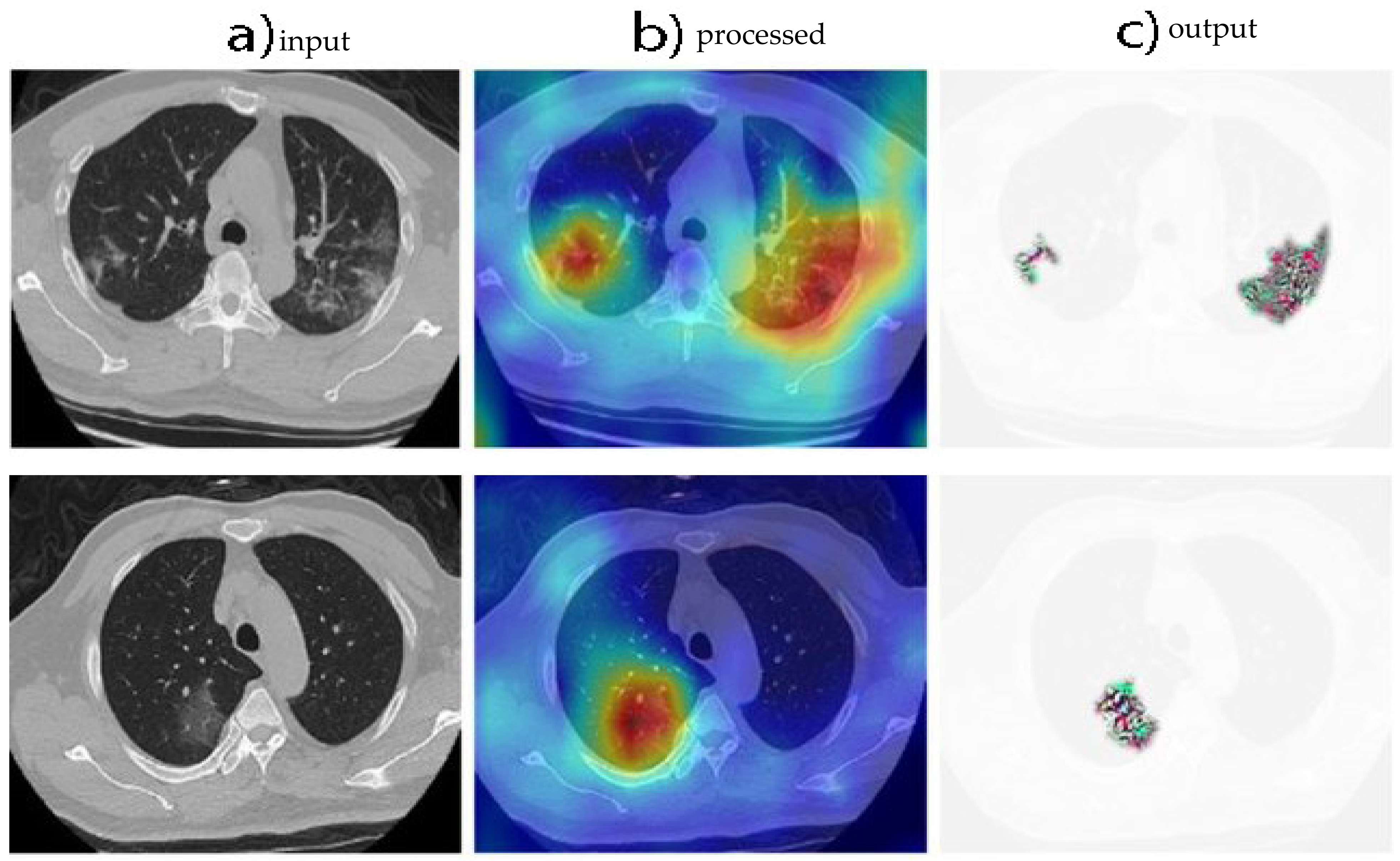 Diagnostics 13 00800 g006 Diagnostics 13 00800 g006