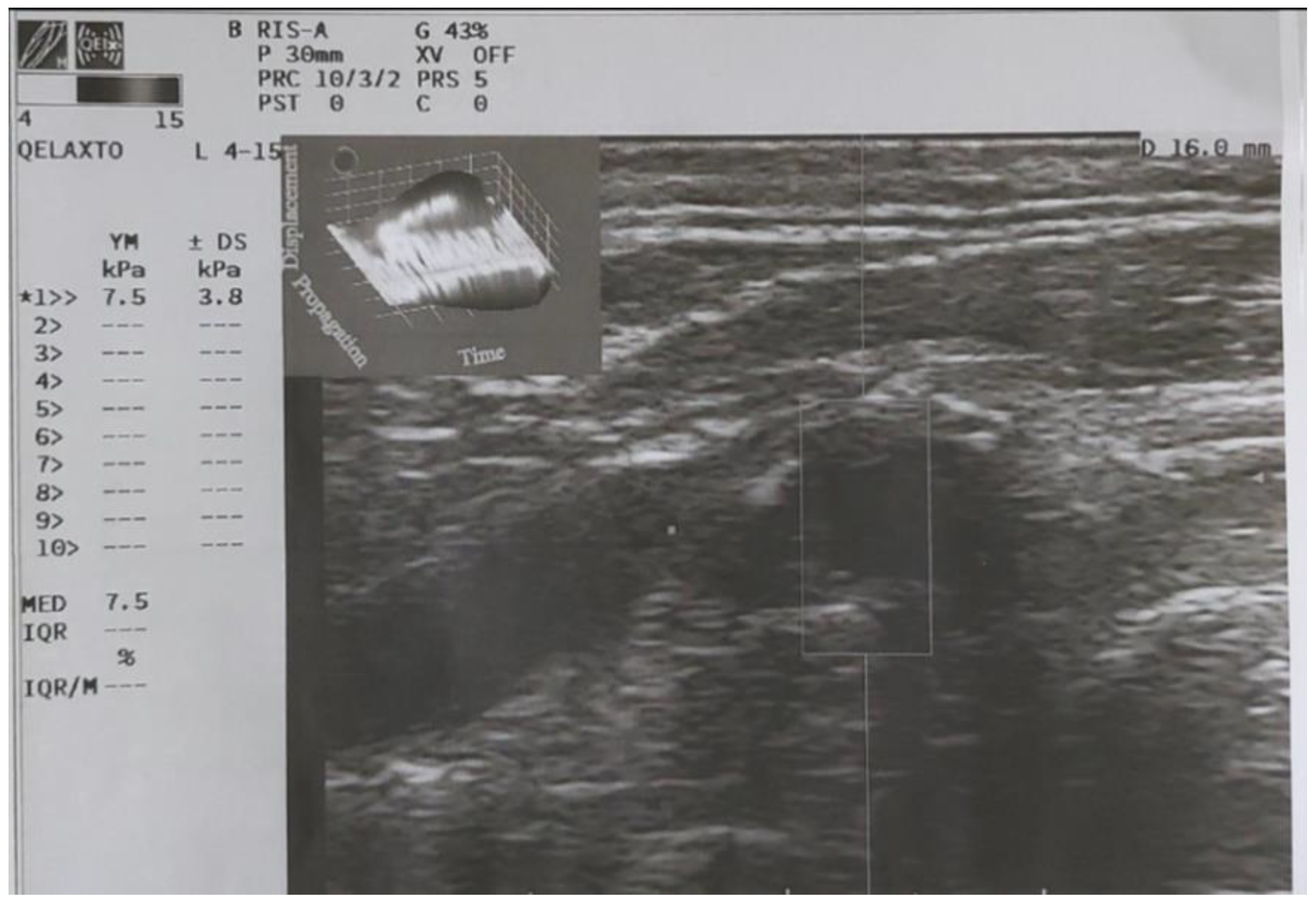 Diagnostics 13 00805 g004