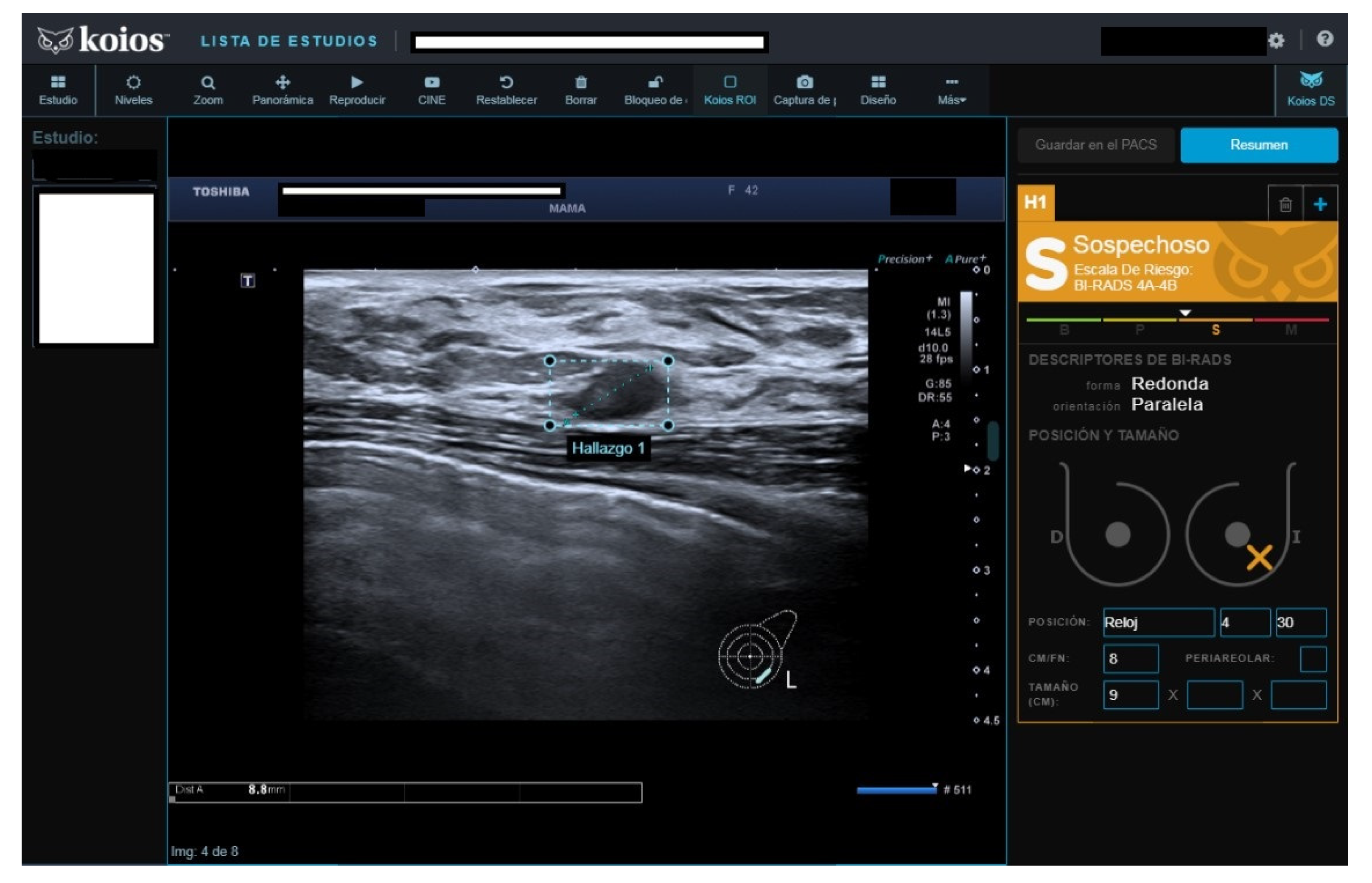 Diagnostics 13 00811 g004