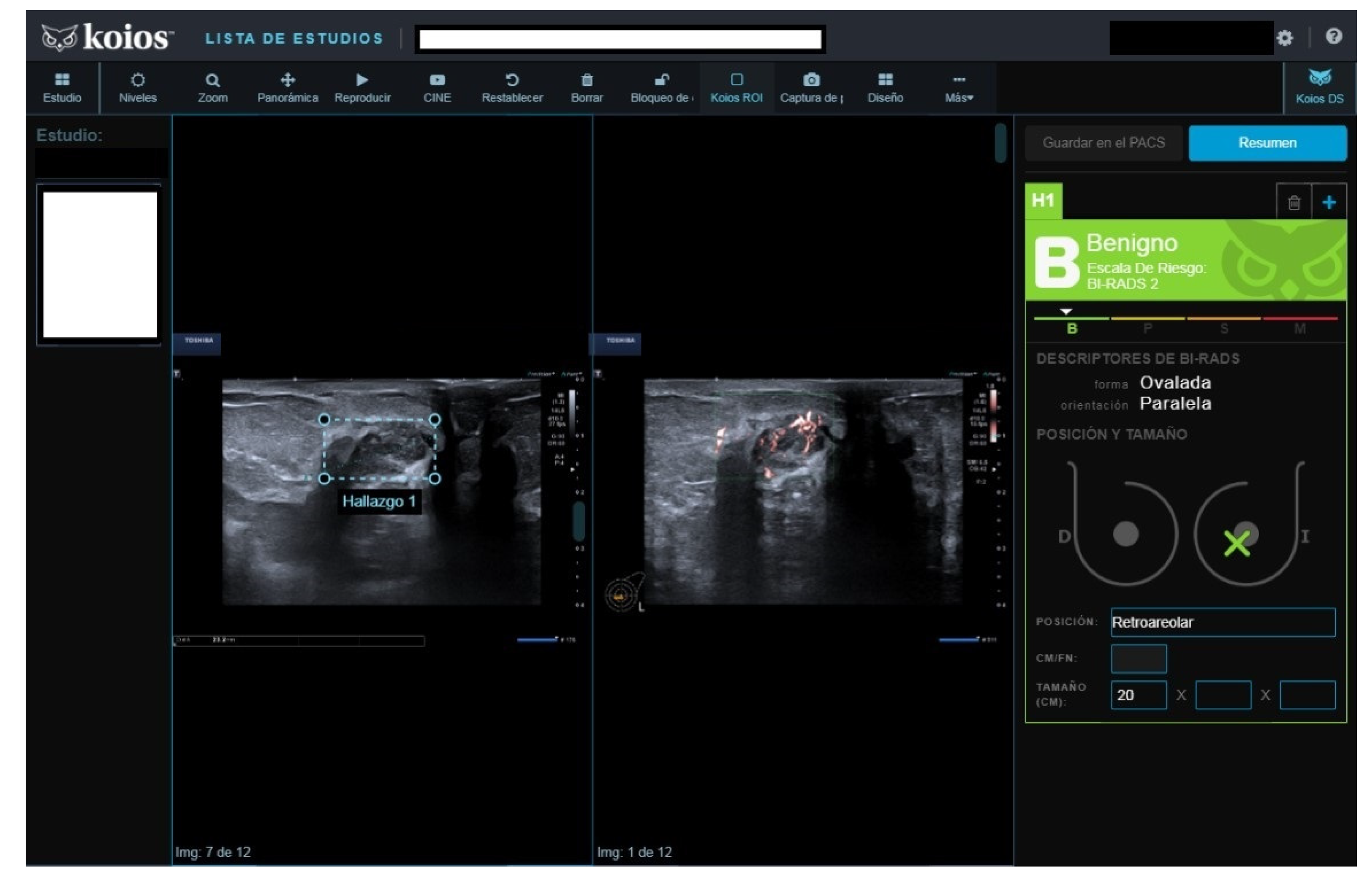 Diagnostics 13 00811 g007