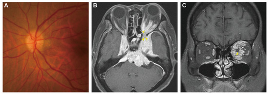 Diagnostics 13 00815 g001