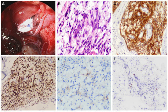 Diagnostics 13 00815 g002