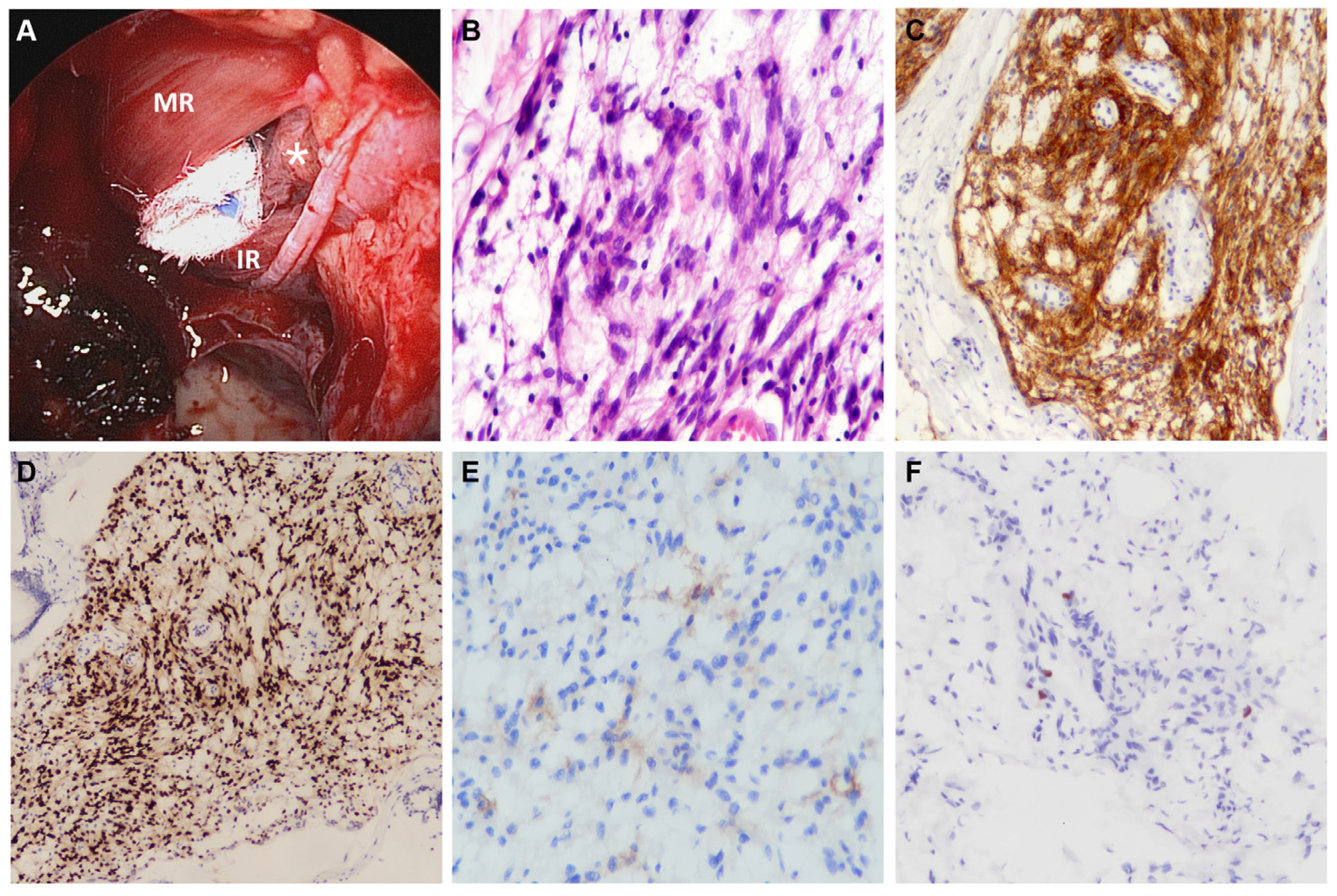 Diagnostics 13 00815 g002