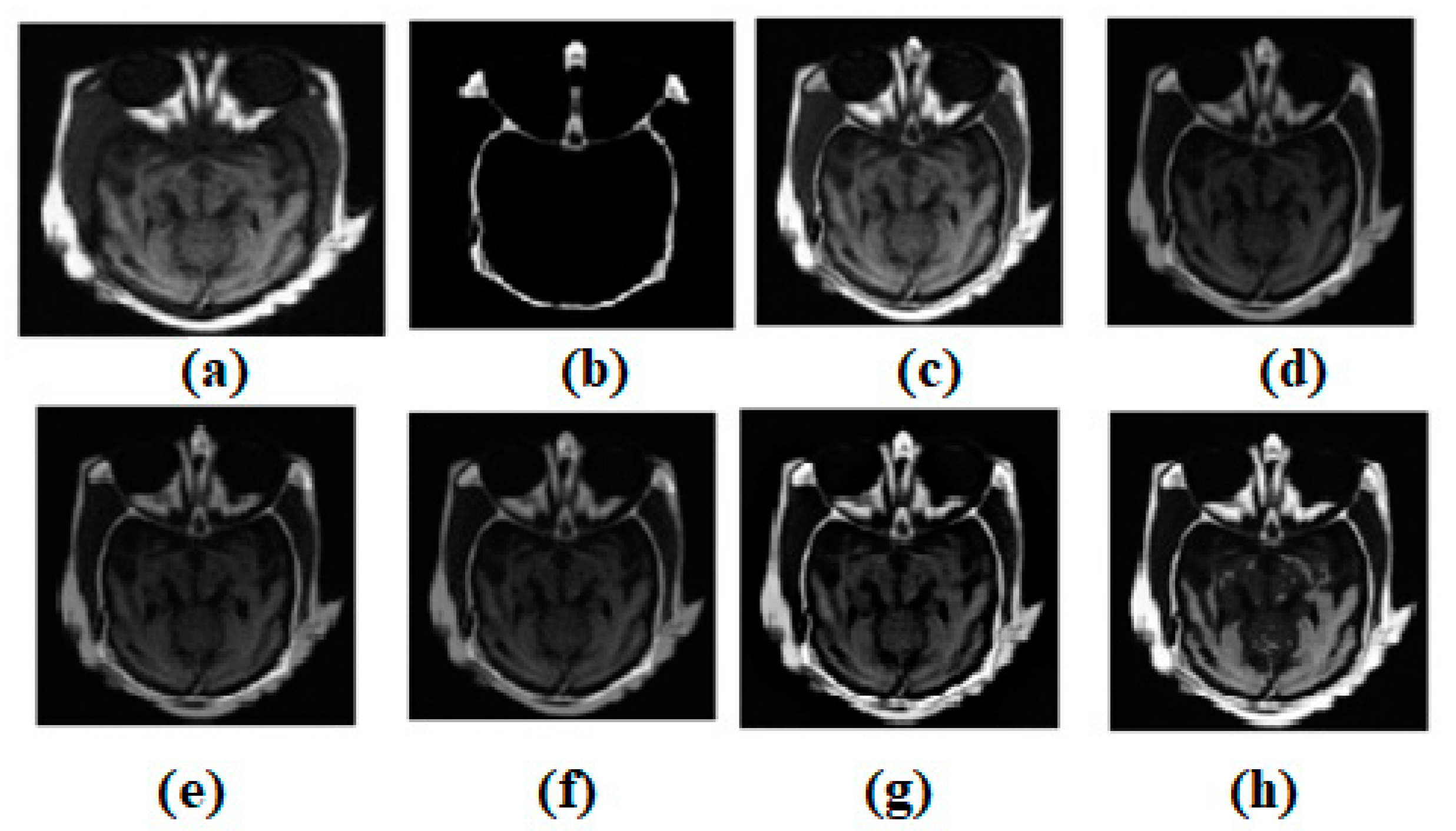 Diagnostics 13 00820 g003
