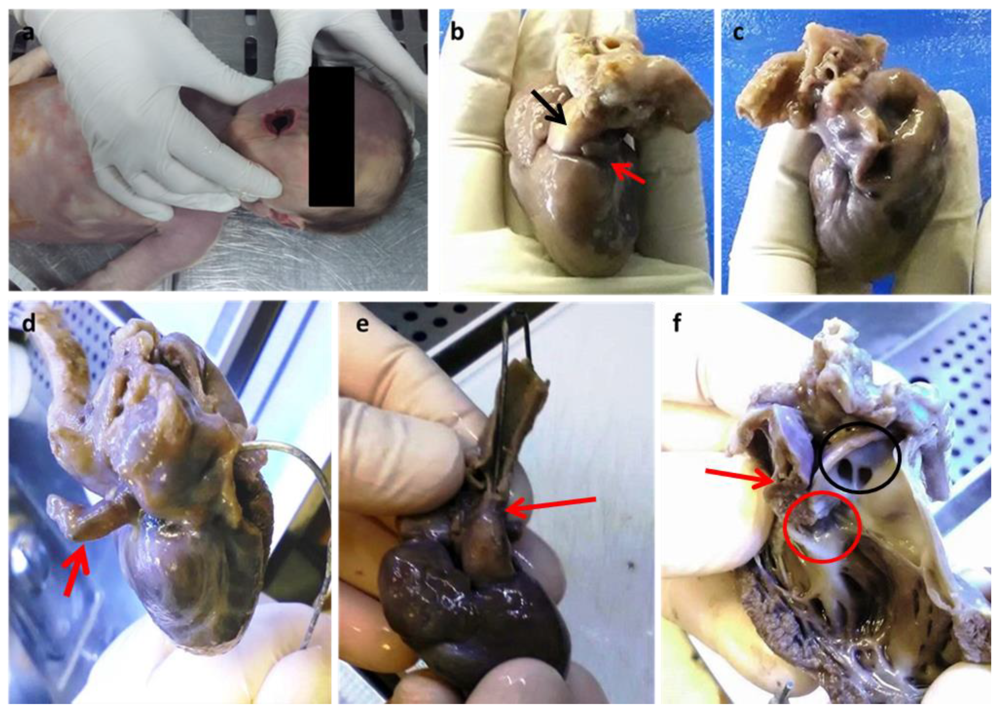 Diagnostics 13 00821 g001