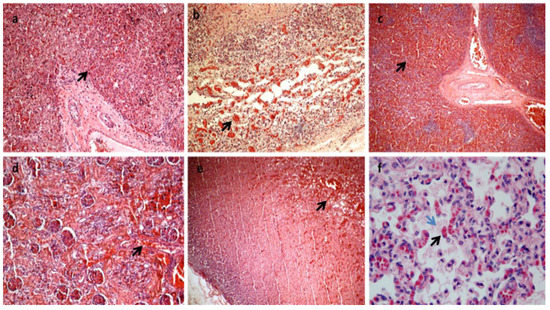 Diagnostics 13 00821 g002