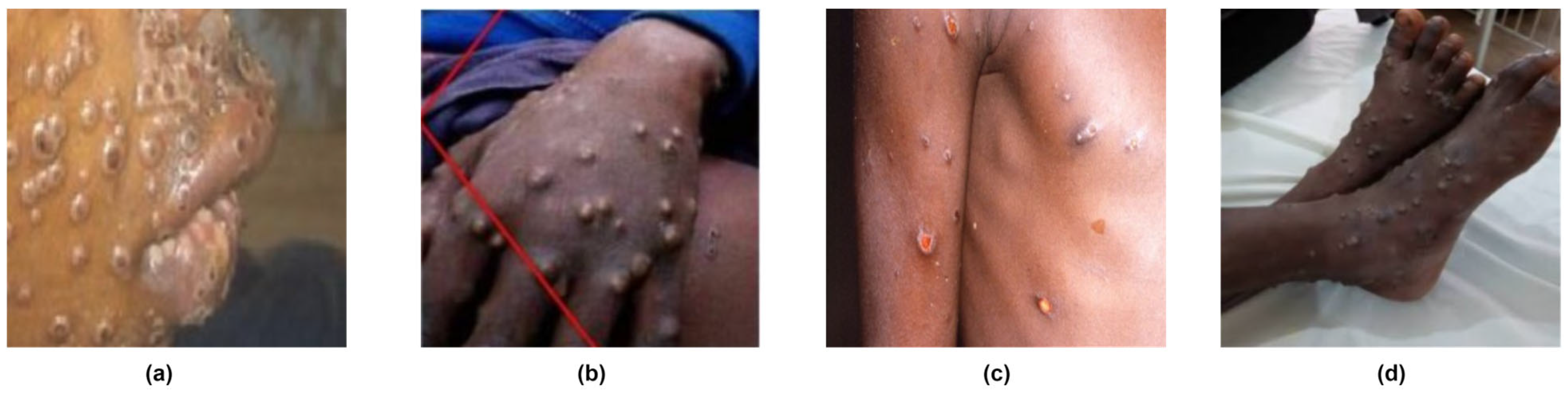 Diagnostics 13 00824 g001