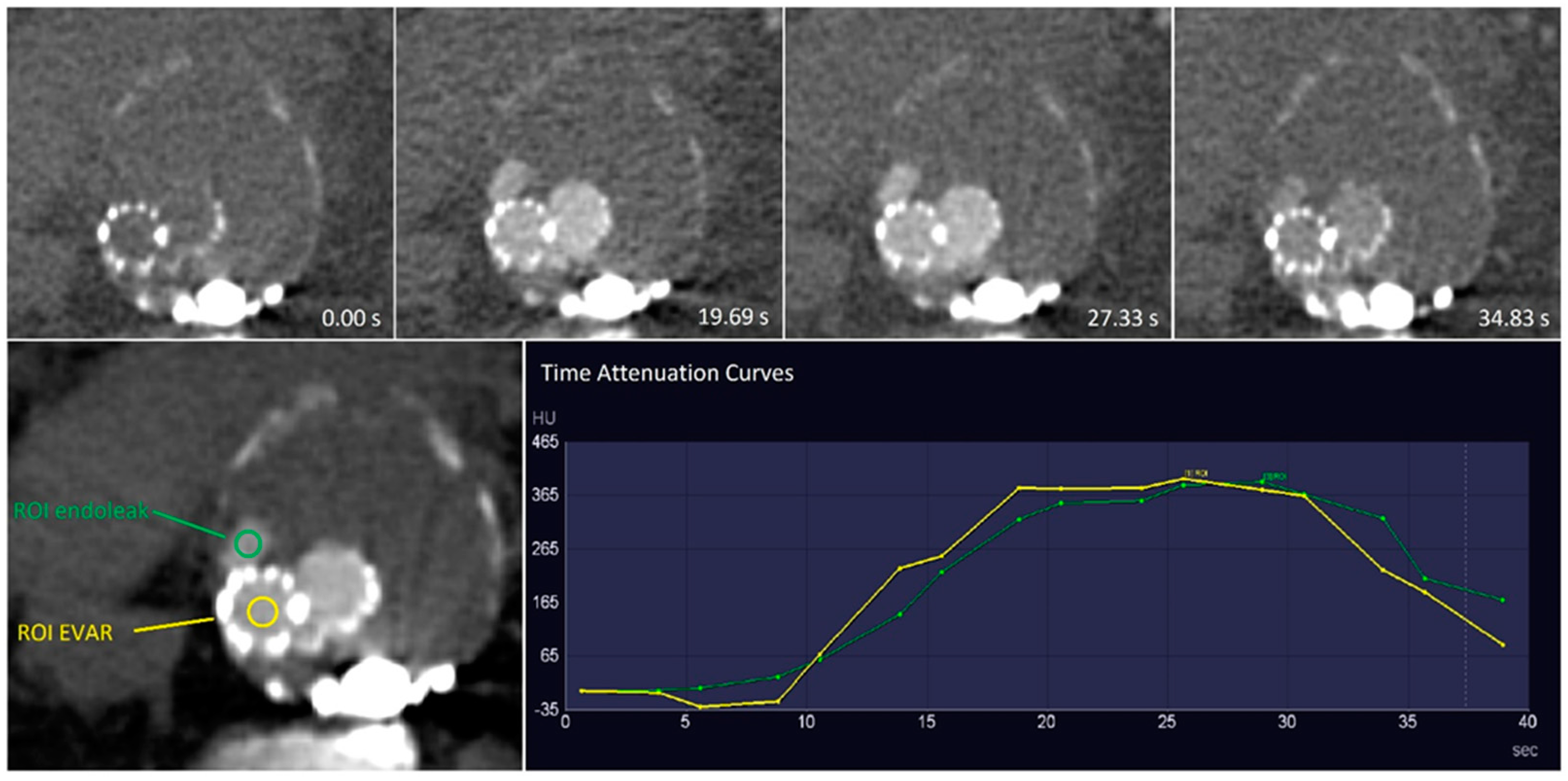 Diagnostics 13 00829 g001
